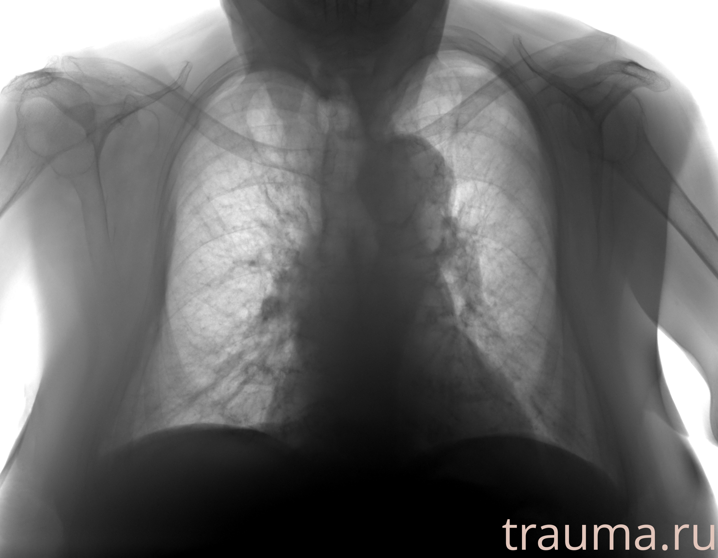 Рентген на дому: по вашему адресу приезжает врач-рентгенолог, травматолог-ортопед с мобильным рентгеновским аппаратом, проводит диагностику травмы или заболевания, делает необходимые рентгенограммы, дает рекомендации по дальнейшему лечению. Получить качественные снимки в домашних условиях возможно благодаря уникальной методике, разработанной МосРентген Центром для института  Склифосовского