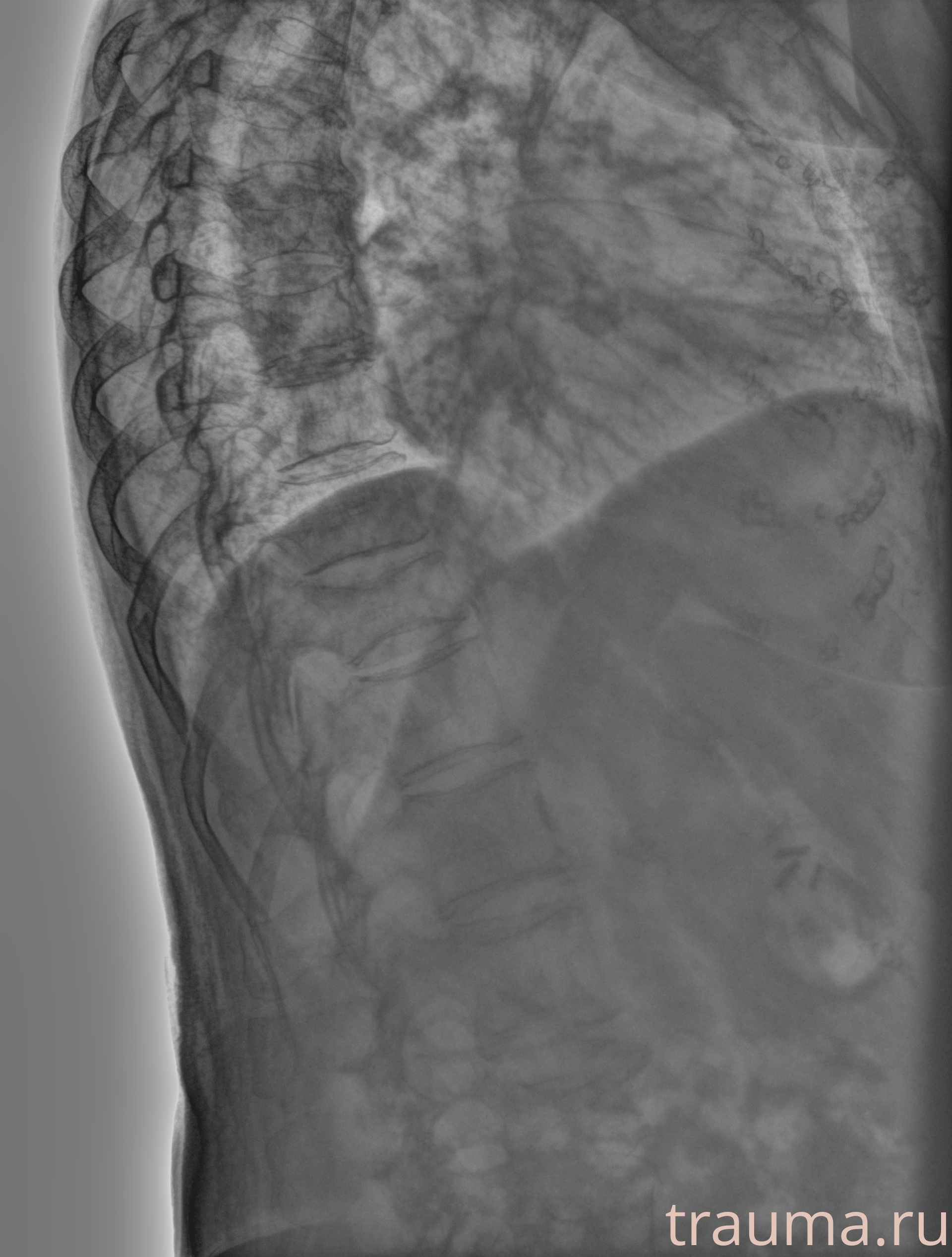 Рентген на дому: по вашему адресу приезжает врач-рентгенолог, травматолог-ортопед с мобильным рентгеновским аппаратом, проводит диагностику травмы или заболевания, делает необходимые рентгенограммы, дает рекомендации по дальнейшему лечению. Получить качественные снимки в домашних условиях возможно благодаря уникальной методике, разработанной МосРентген Центром для института  Склифосовского