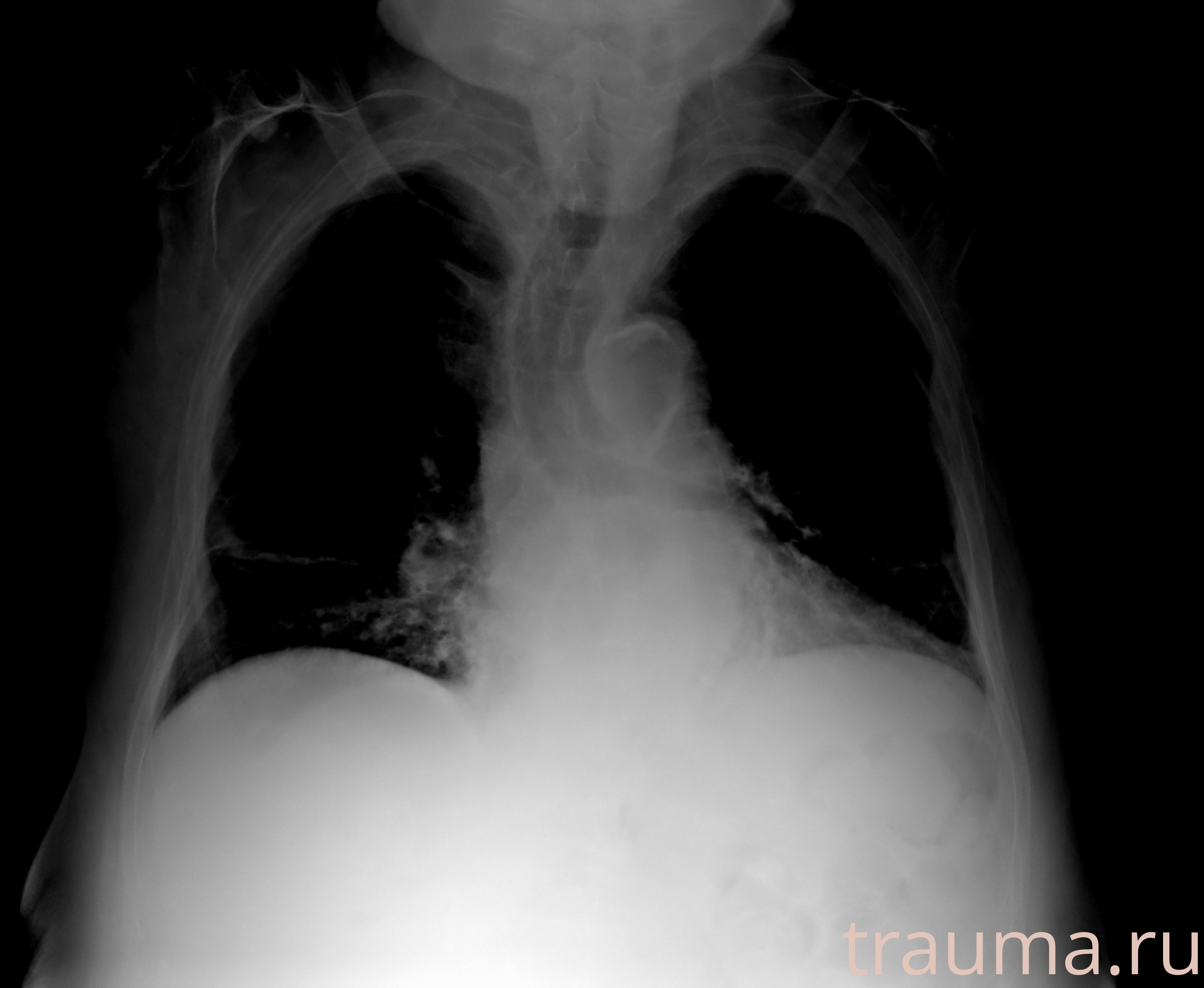 Рентген на дому: по вашему адресу приезжает врач-рентгенолог, травматолог-ортопед с мобильным рентгеновским аппаратом, проводит диагностику травмы или заболевания, делает необходимые рентгенограммы, дает рекомендации по дальнейшему лечению. Получить качественные снимки в домашних условиях возможно благодаря уникальной методике, разработанной МосРентген Центром для института  Склифосовского