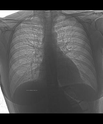 Как записать рентген, КТ, МРТ на СД-диск.