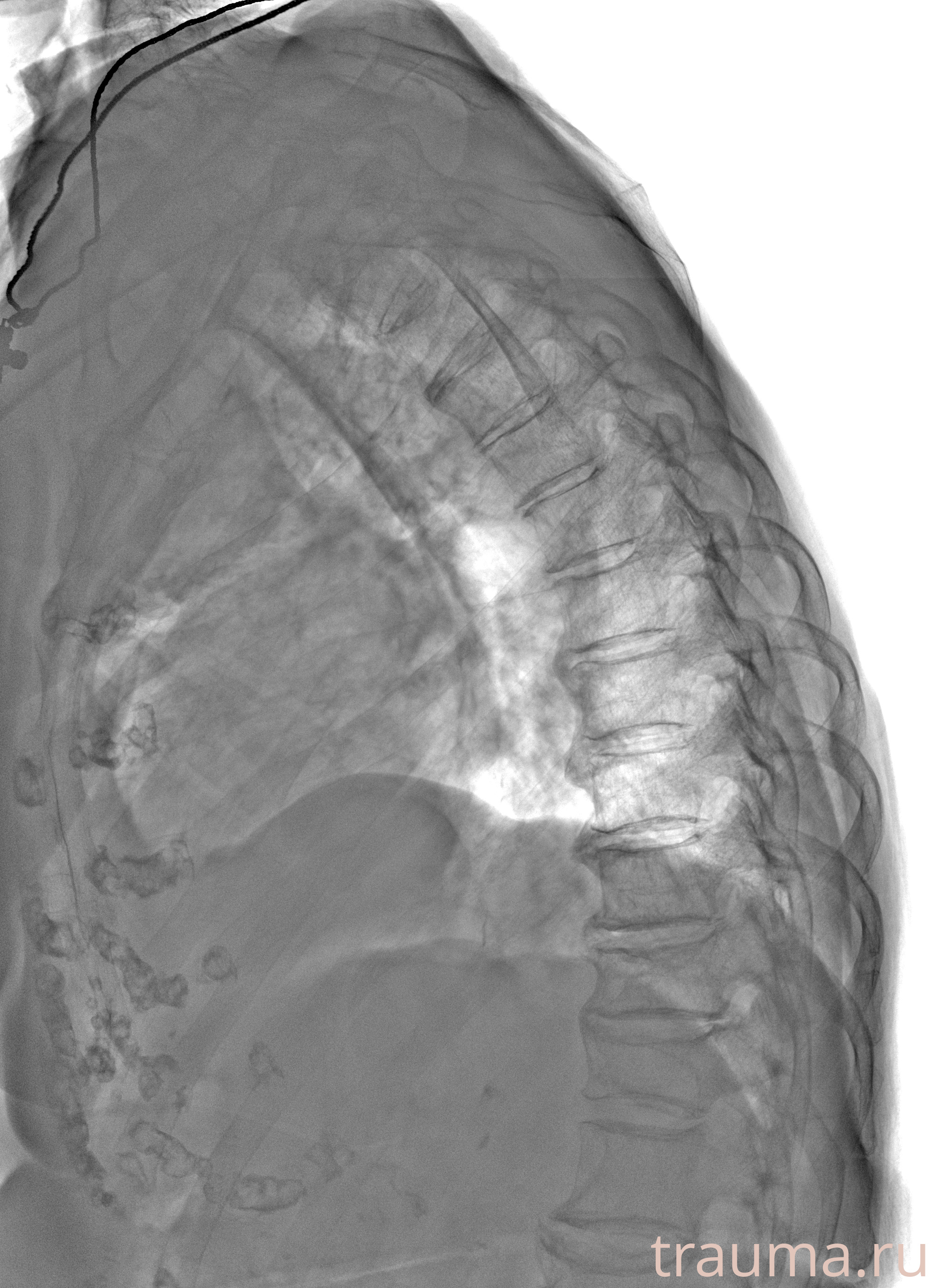 Рентген на дому: по вашему адресу приезжает врач-рентгенолог, травматолог-ортопед с мобильным рентгеновским аппаратом, проводит диагностику травмы или заболевания, делает необходимые рентгенограммы, дает рекомендации по дальнейшему лечению. Получить качественные снимки в домашних условиях возможно благодаря уникальной методике, разработанной МосРентген Центром для института  Склифосовского