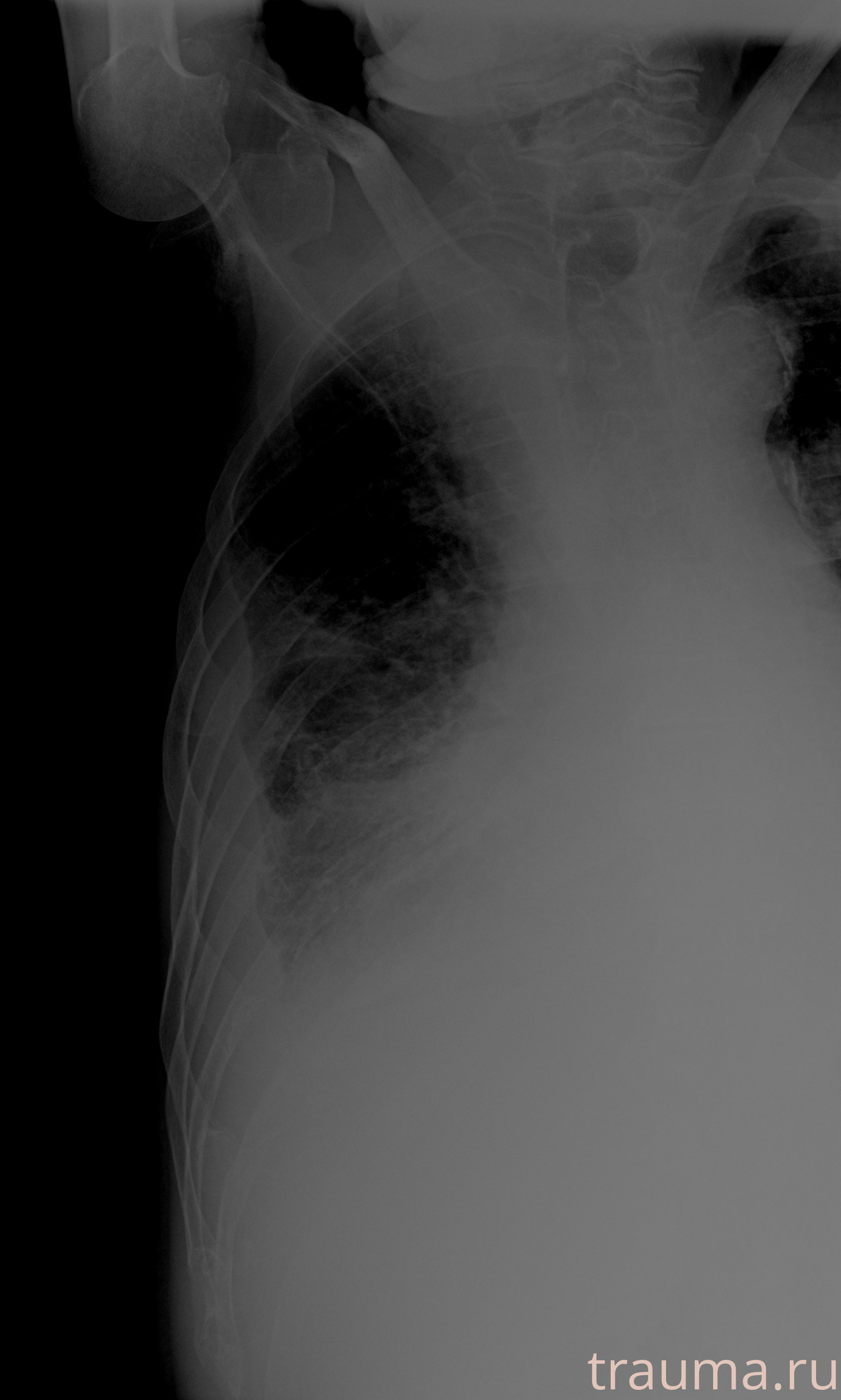 Рентген на дому: по вашему адресу приезжает врач-рентгенолог, травматолог-ортопед с мобильным рентгеновским аппаратом, проводит диагностику травмы или заболевания, делает необходимые рентгенограммы, дает рекомендации по дальнейшему лечению. Получить качественные снимки в домашних условиях возможно благодаря уникальной методике, разработанной МосРентген Центром для института  Склифосовского