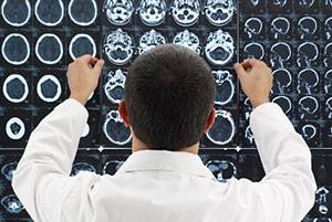 Диффузионно-куртозисная магнитно-резонансная   томография: новый метод характеристики
структурной  организации мозгового вещества (предварительные  результаты у здоровых добровольцев)