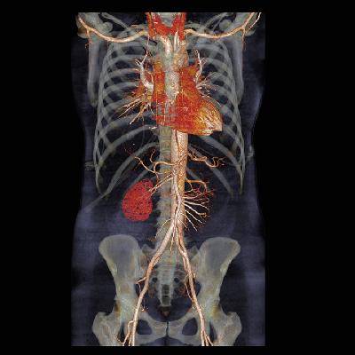 Рентген обнаружил пакетик с гашишем в желудке