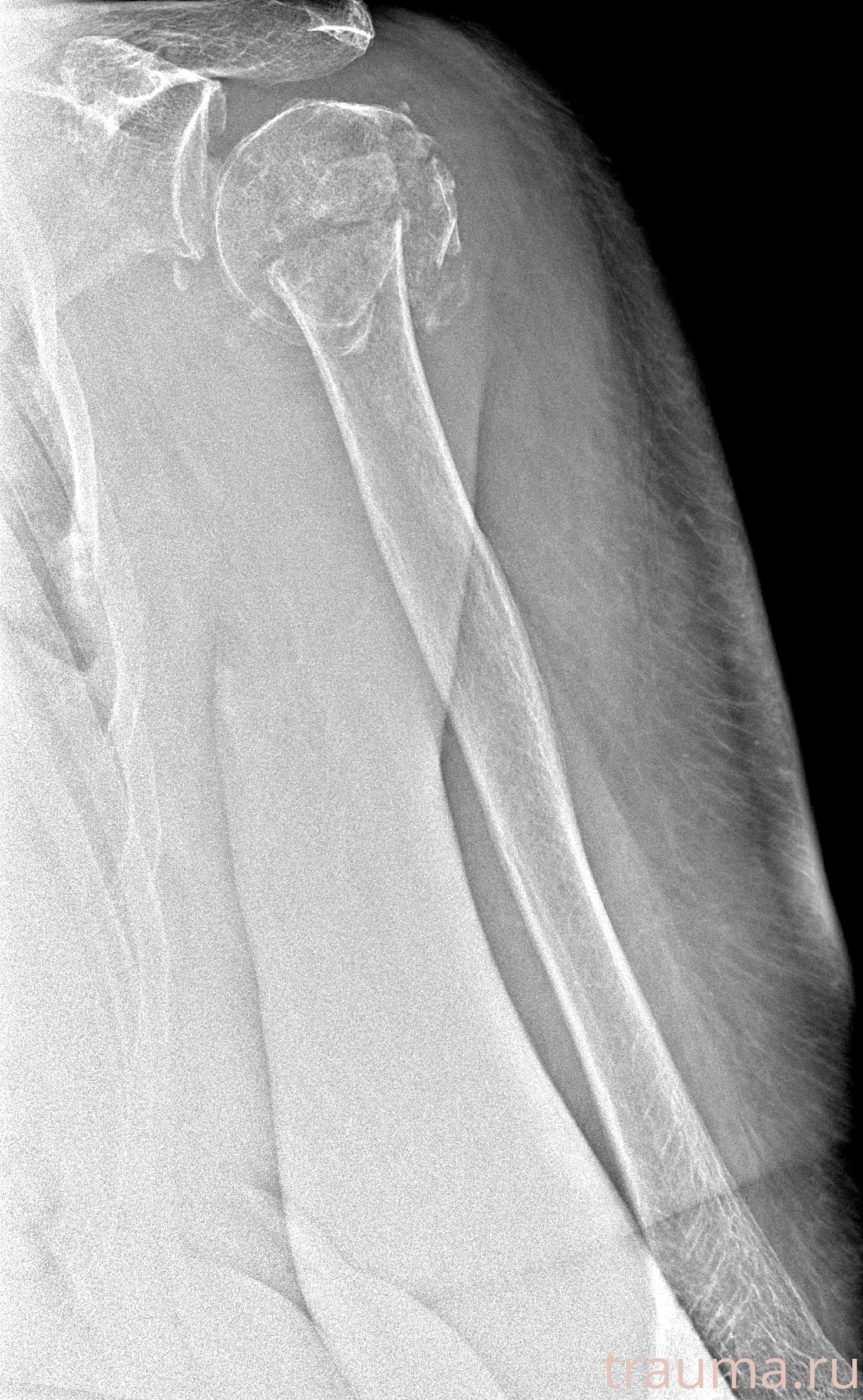 Рентген на дому: по вашему адресу приезжает врач-рентгенолог, травматолог-ортопед с мобильным рентгеновским аппаратом, проводит диагностику травмы или заболевания, делает необходимые рентгенограммы, дает рекомендации по дальнейшему лечению. Получить качественные снимки в домашних условиях возможно благодаря уникальной методике, разработанной МосРентген Центром для института  Склифосовского