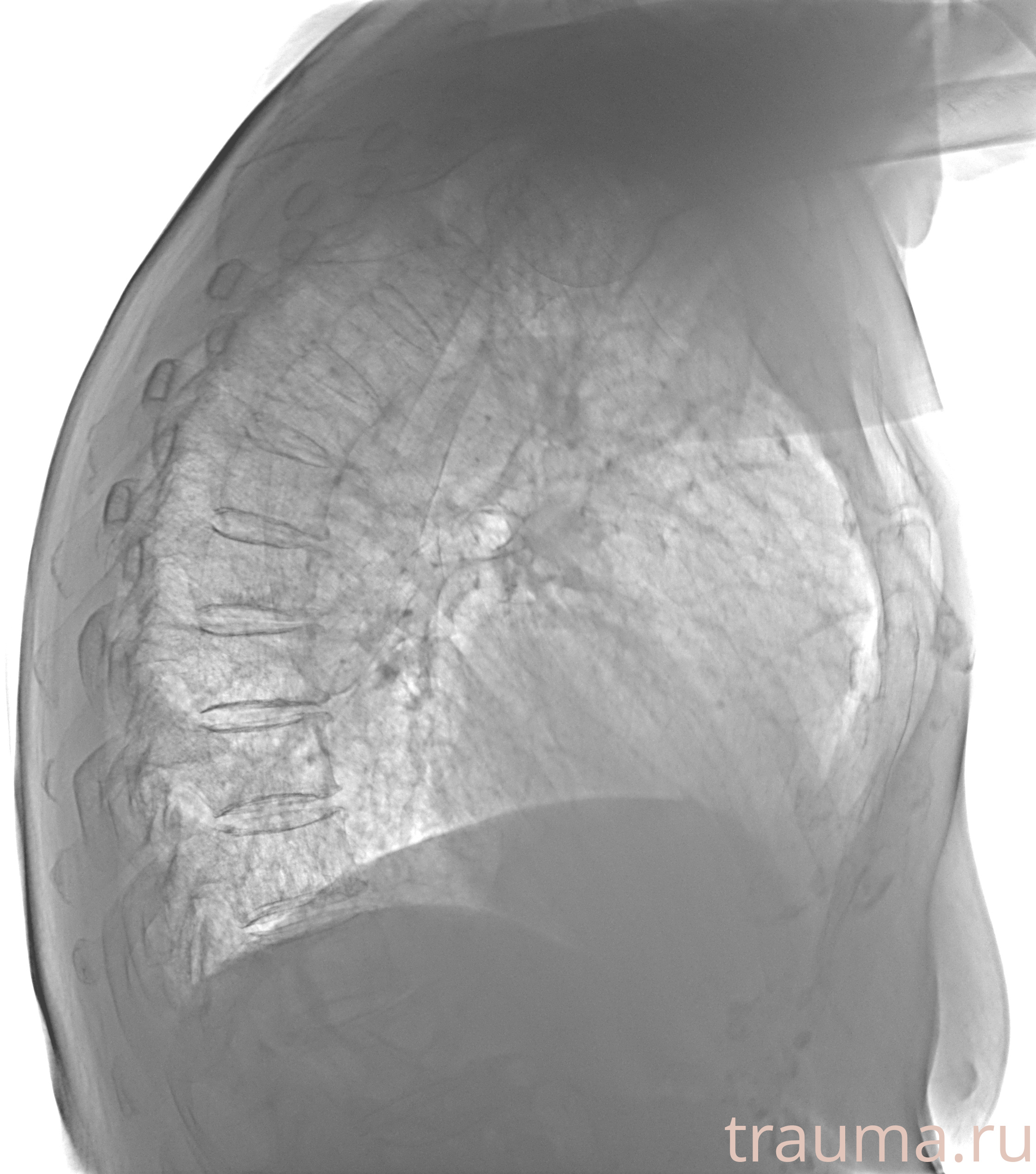 Рентген на дому: по вашему адресу приезжает врач-рентгенолог, травматолог-ортопед с мобильным рентгеновским аппаратом, проводит диагностику травмы или заболевания, делает необходимые рентгенограммы, дает рекомендации по дальнейшему лечению. Получить качественные снимки в домашних условиях возможно благодаря уникальной методике, разработанной МосРентген Центром для института  Склифосовского