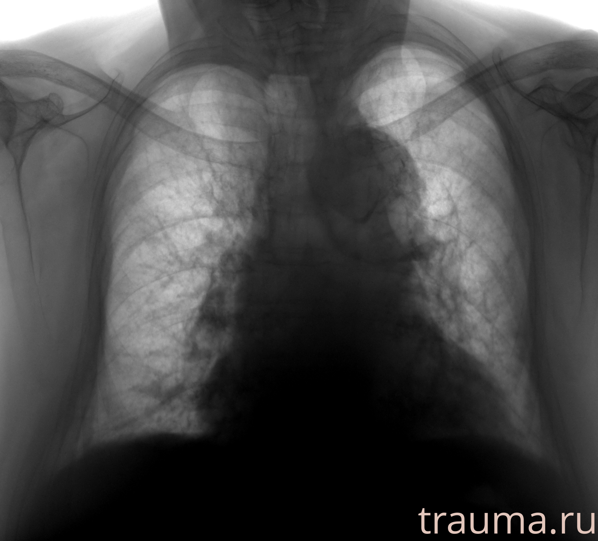 Рентген на дому: по вашему адресу приезжает врач-рентгенолог, травматолог-ортопед с мобильным рентгеновским аппаратом, проводит диагностику травмы или заболевания, делает необходимые рентгенограммы, дает рекомендации по дальнейшему лечению. Получить качественные снимки в домашних условиях возможно благодаря уникальной методике, разработанной МосРентген Центром для института  Склифосовского