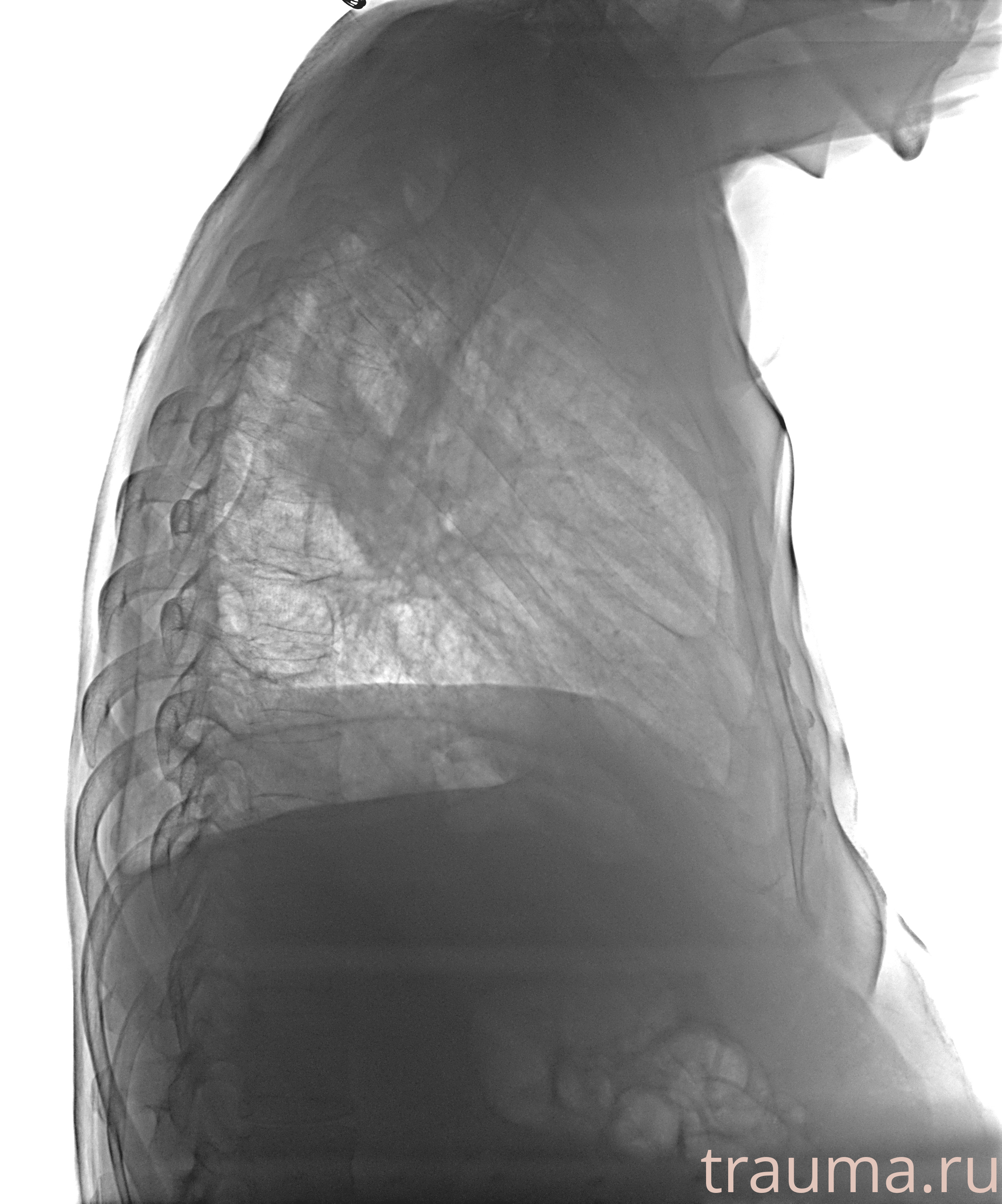 Рентген на дому: по вашему адресу приезжает врач-рентгенолог, травматолог-ортопед с мобильным рентгеновским аппаратом, проводит диагностику травмы или заболевания, делает необходимые рентгенограммы, дает рекомендации по дальнейшему лечению. Получить качественные снимки в домашних условиях возможно благодаря уникальной методике, разработанной МосРентген Центром для института  Склифосовского