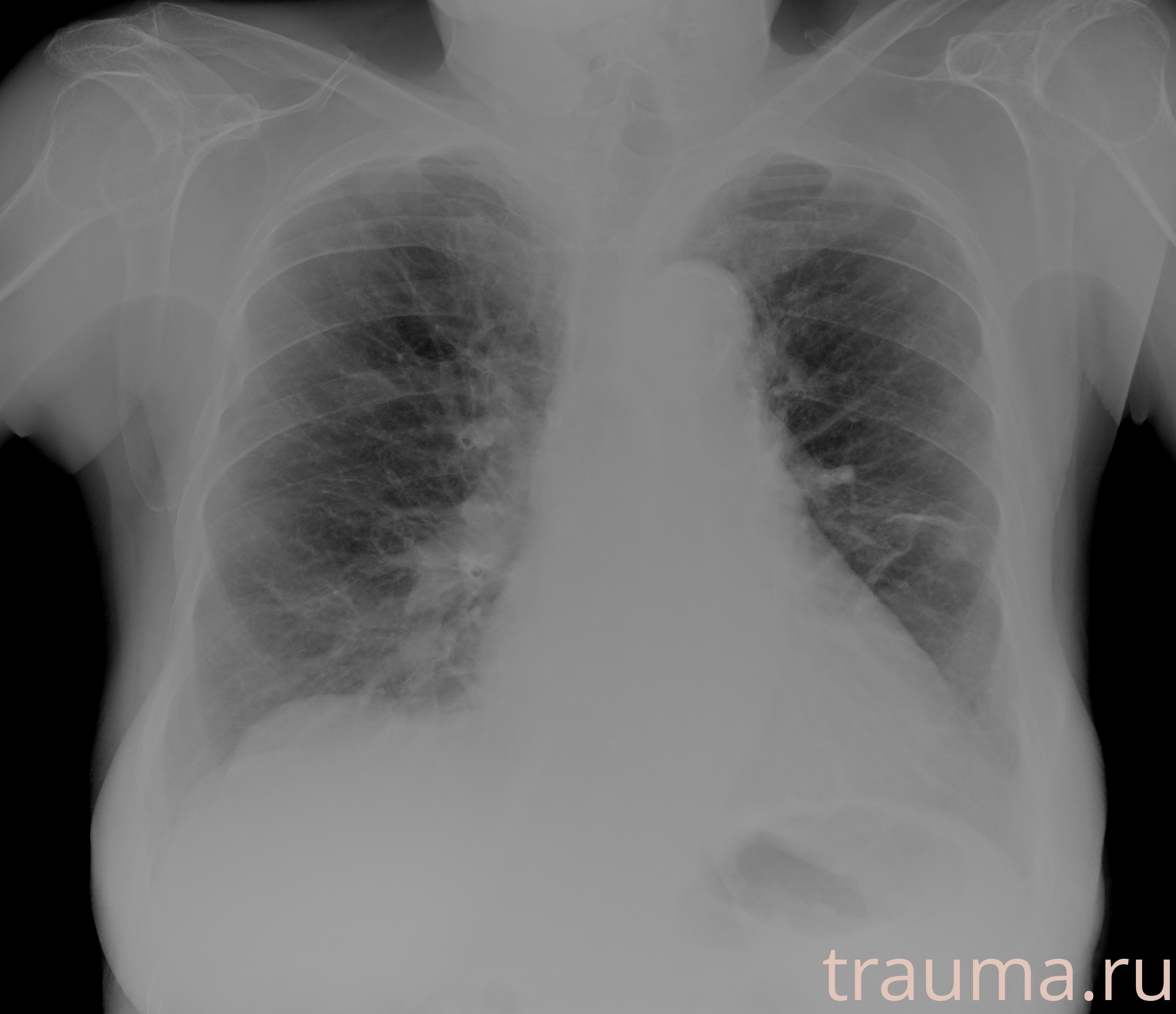 Рентген на дому: по вашему адресу приезжает врач-рентгенолог, травматолог-ортопед с мобильным рентгеновским аппаратом, проводит диагностику травмы или заболевания, делает необходимые рентгенограммы, дает рекомендации по дальнейшему лечению. Получить качественные снимки в домашних условиях возможно благодаря уникальной методике, разработанной МосРентген Центром для института  Склифосовского