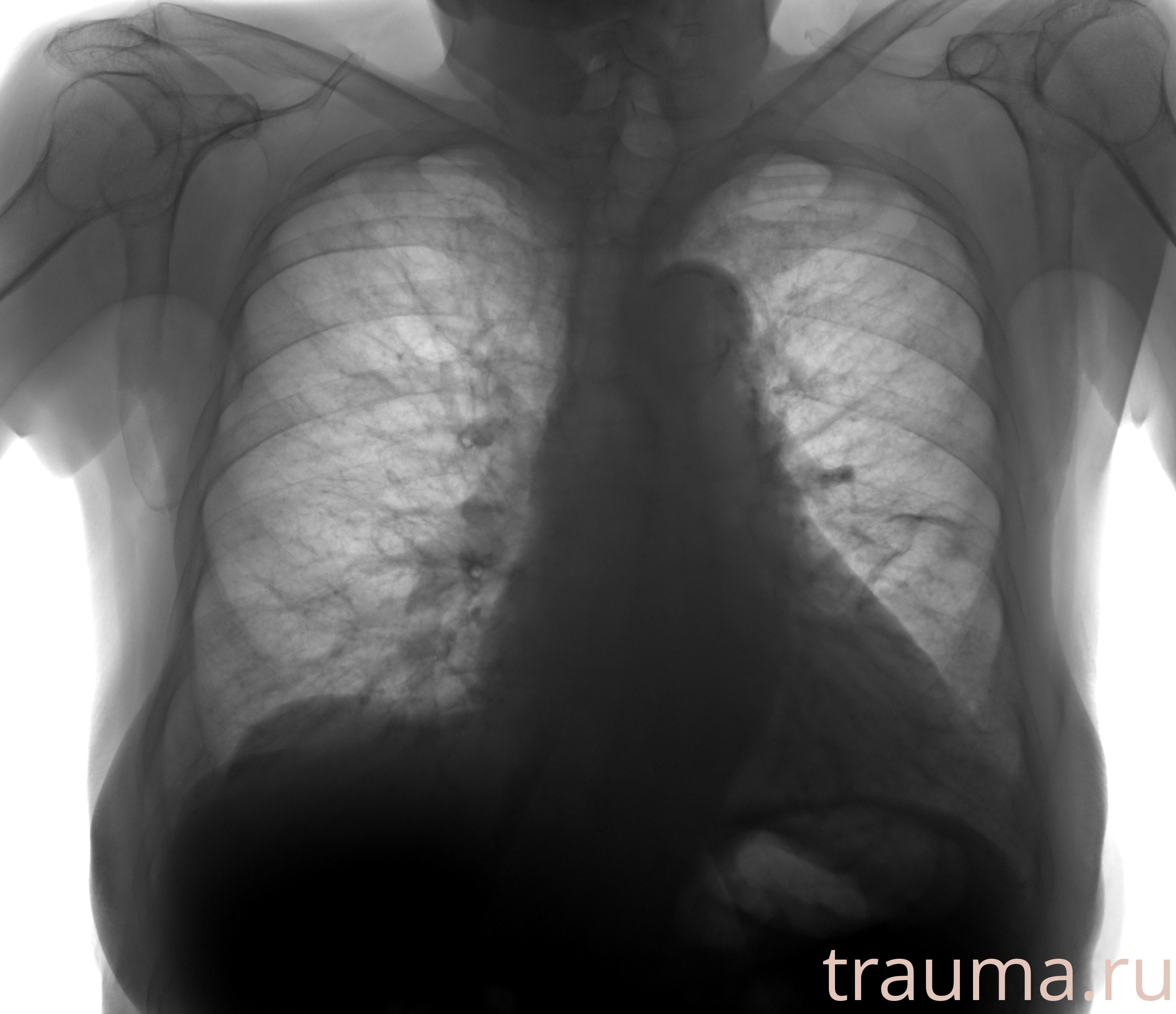 Рентген на дому: по вашему адресу приезжает врач-рентгенолог, травматолог-ортопед с мобильным рентгеновским аппаратом, проводит диагностику травмы или заболевания, делает необходимые рентгенограммы, дает рекомендации по дальнейшему лечению. Получить качественные снимки в домашних условиях возможно благодаря уникальной методике, разработанной МосРентген Центром для института  Склифосовского