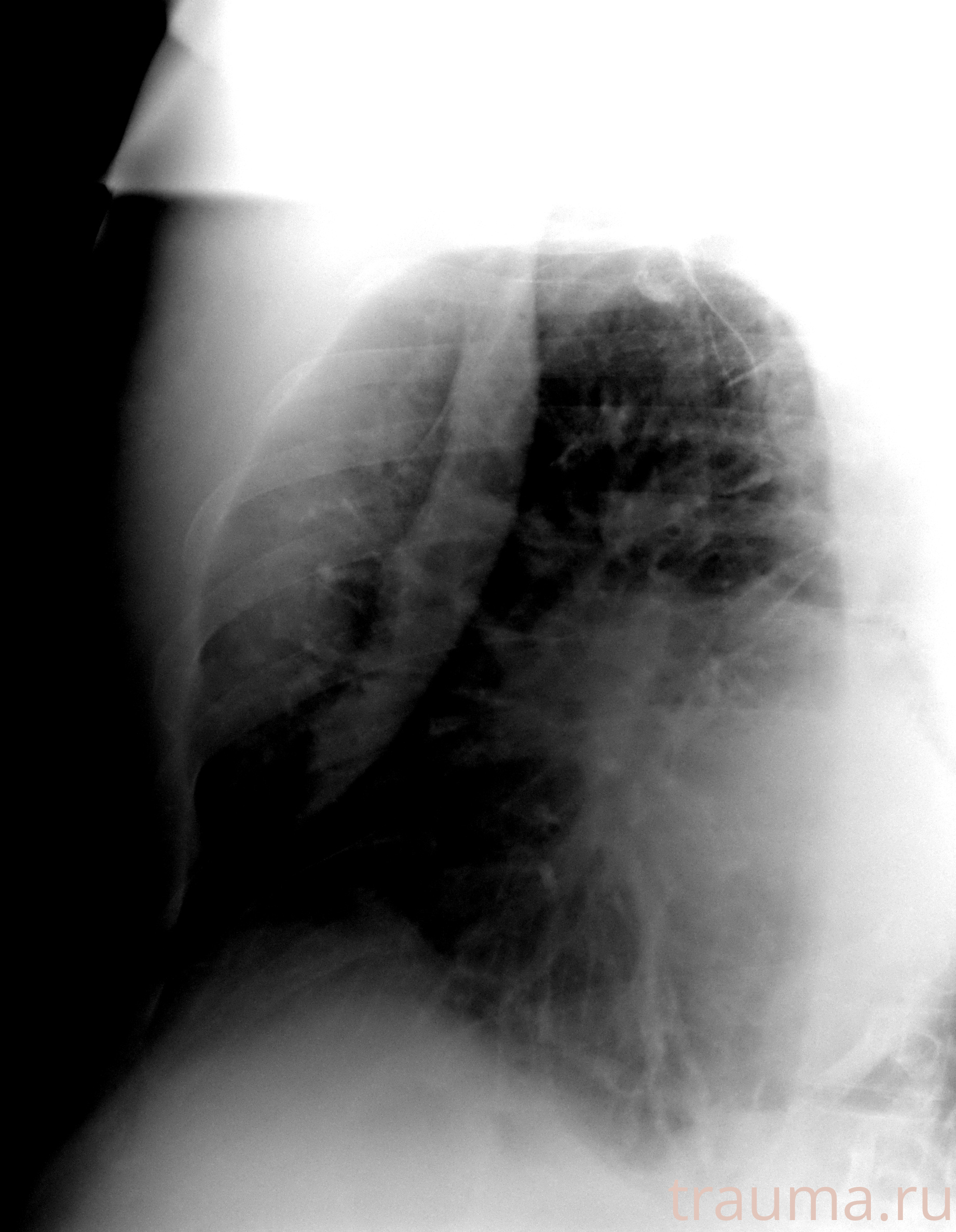 Рентген на дому: по вашему адресу приезжает врач-рентгенолог, травматолог-ортопед с мобильным рентгеновским аппаратом, проводит диагностику травмы или заболевания, делает необходимые рентгенограммы, дает рекомендации по дальнейшему лечению. Получить качественные снимки в домашних условиях возможно благодаря уникальной методике, разработанной МосРентген Центром для института  Склифосовского