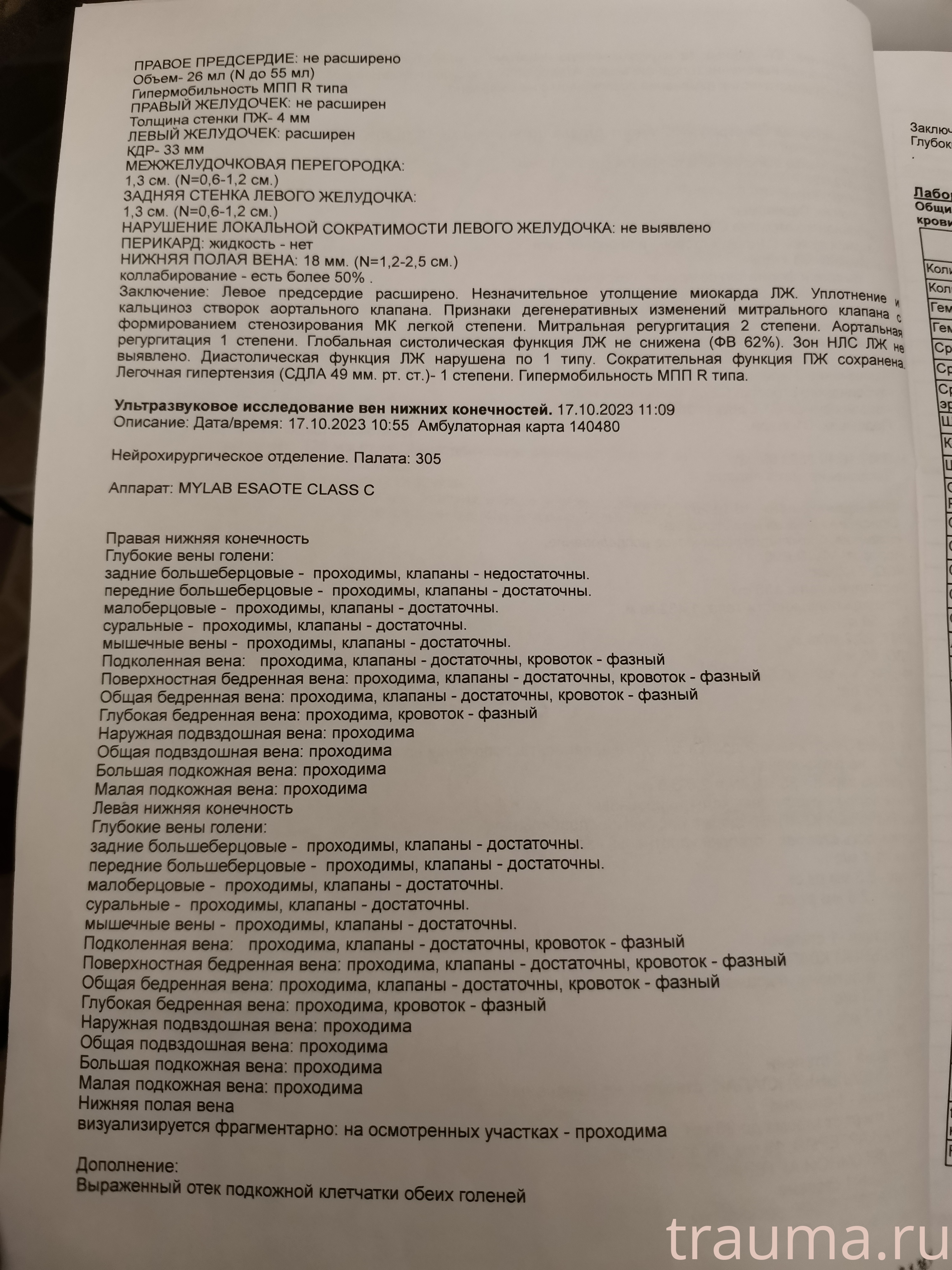 Рентген на дому: по вашему адресу приезжает врач-рентгенолог, травматолог-ортопед с мобильным рентгеновским аппаратом, проводит диагностику травмы или заболевания, делает необходимые рентгенограммы, дает рекомендации по дальнейшему лечению. Получить качественные снимки в домашних условиях возможно благодаря уникальной методике, разработанной МосРентген Центром для института  Склифосовского