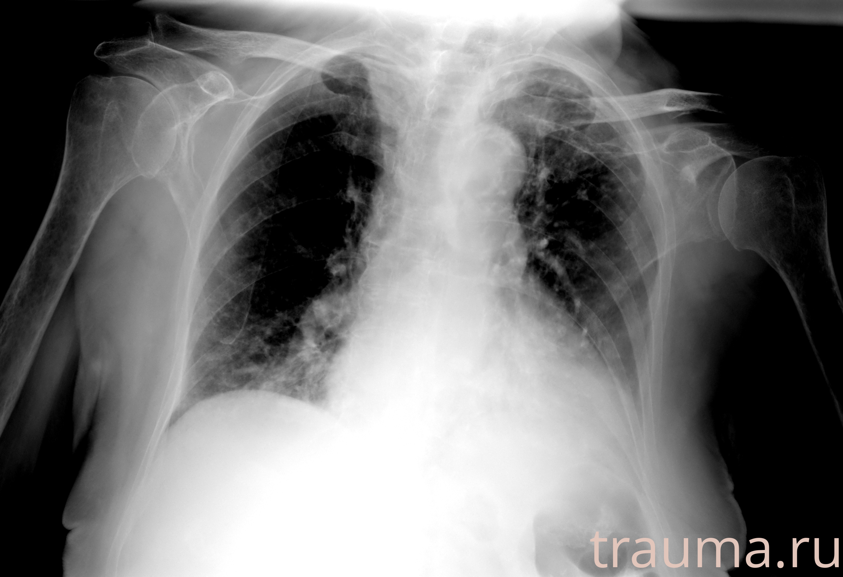 Рентген на дому: по вашему адресу приезжает врач-рентгенолог, травматолог-ортопед с мобильным рентгеновским аппаратом, проводит диагностику травмы или заболевания, делает необходимые рентгенограммы, дает рекомендации по дальнейшему лечению. Получить качественные снимки в домашних условиях возможно благодаря уникальной методике, разработанной МосРентген Центром для института  Склифосовского