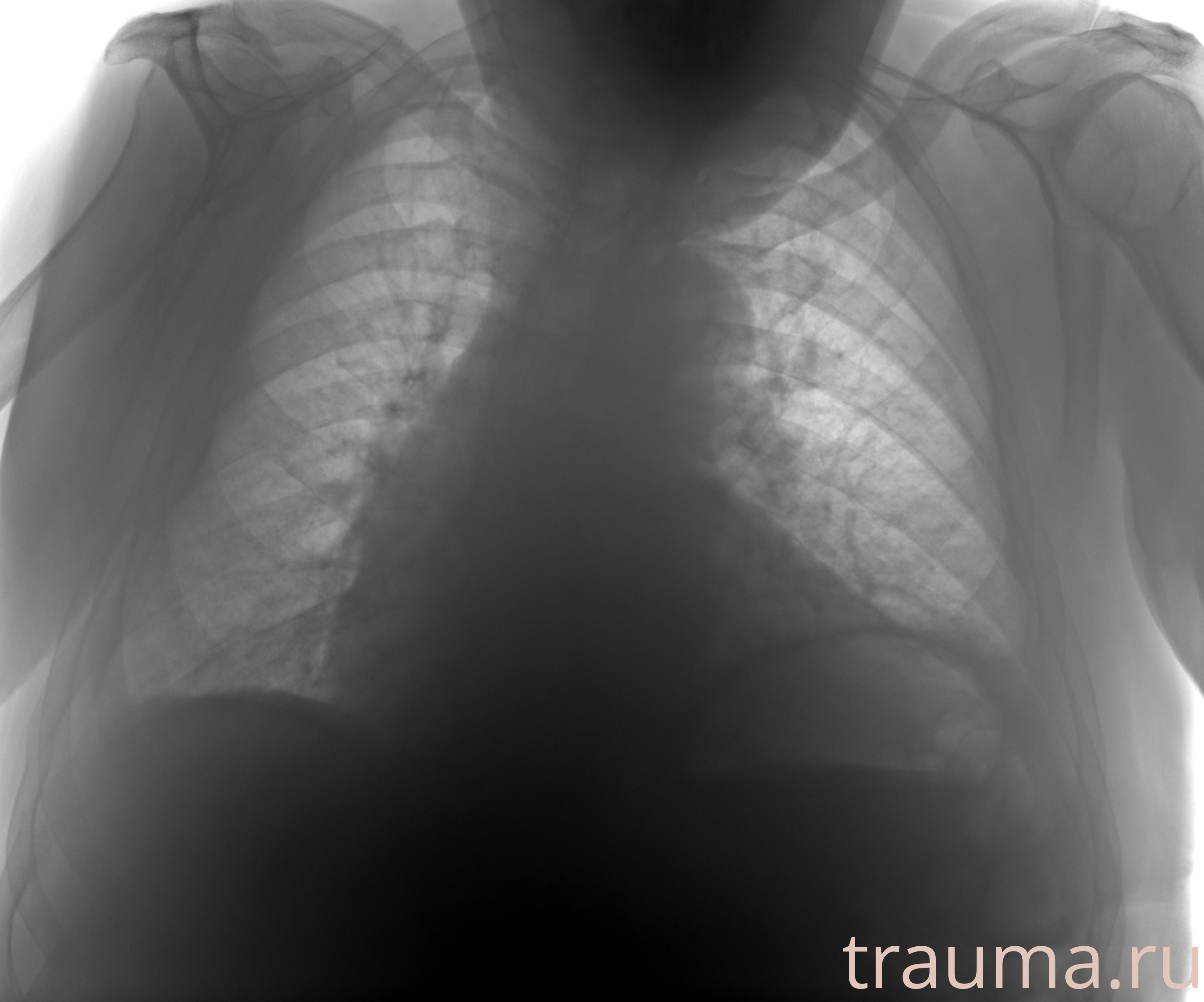 Рентген на дому: по вашему адресу приезжает врач-рентгенолог, травматолог-ортопед с мобильным рентгеновским аппаратом, проводит диагностику травмы или заболевания, делает необходимые рентгенограммы, дает рекомендации по дальнейшему лечению. Получить качественные снимки в домашних условиях возможно благодаря уникальной методике, разработанной МосРентген Центром для института  Склифосовского