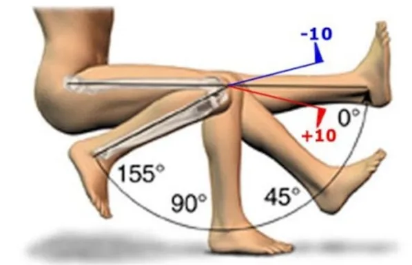 Степени свободы суставов. Угол сгибания колена. Угол сгиба коленного сустава после эндопротезирования. Угол сгибания ноги. Градус сгибания колена после эндопротезирования.