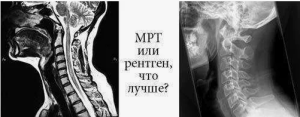 Автоматическое распознавание патологий на рентгеновских, КТ и МРТ снимках Автоматическое распознавание патологий на рентгеновских, КТ и МРТ снимках