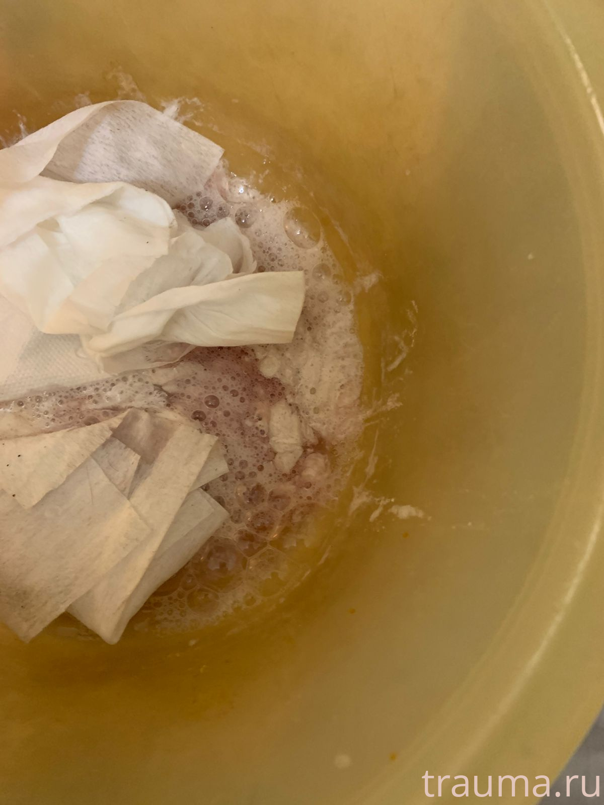 Рентген на дому: по вашему адресу приезжает врач-рентгенолог, травматолог-ортопед с мобильным рентгеновским аппаратом, проводит диагностику травмы или заболевания, делает необходимые рентгенограммы, дает рекомендации по дальнейшему лечению. Получить качественные снимки в домашних условиях возможно благодаря уникальной методике, разработанной МосРентген Центром для института  Склифосовского