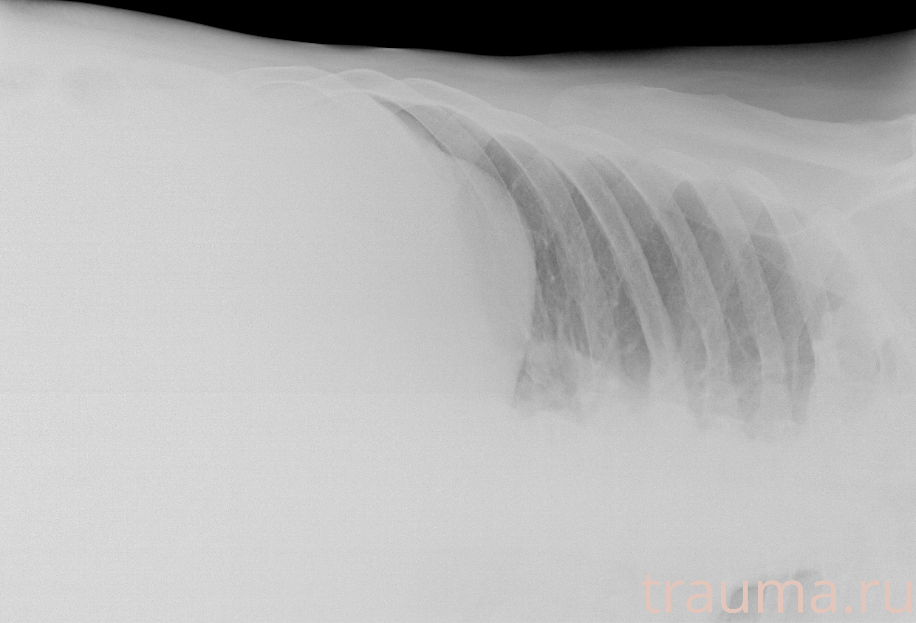 Рентген на дому: по вашему адресу приезжает врач-рентгенолог, травматолог-ортопед с мобильным рентгеновским аппаратом, проводит диагностику травмы или заболевания, делает необходимые рентгенограммы, дает рекомендации по дальнейшему лечению. Получить качественные снимки в домашних условиях возможно благодаря уникальной методике, разработанной МосРентген Центром для института  Склифосовского