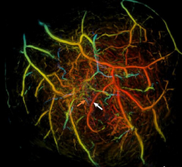 Новый метод томографии объединил УЗИ с лазером