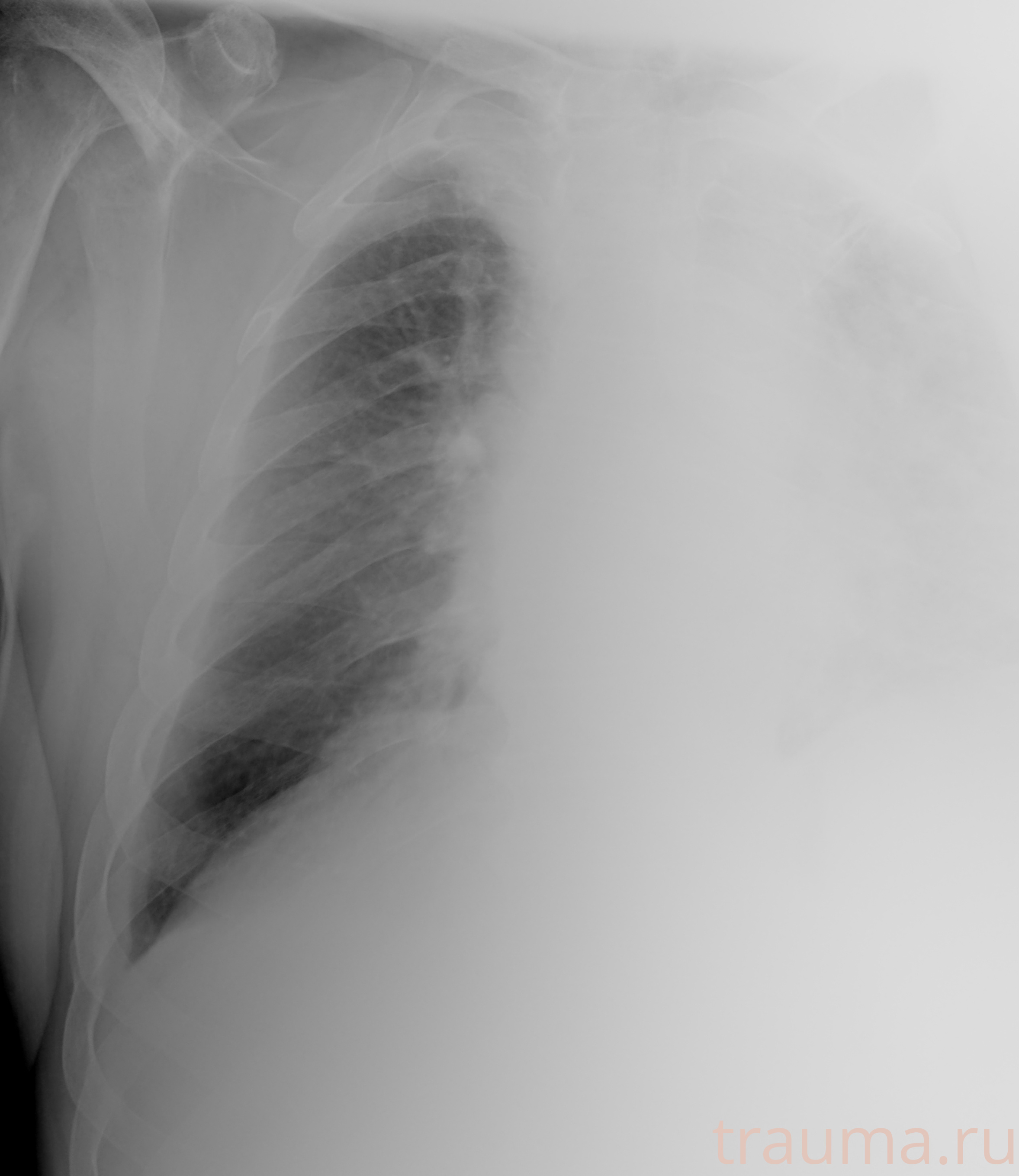 Рентген на дому: по вашему адресу приезжает врач-рентгенолог, травматолог-ортопед с мобильным рентгеновским аппаратом, проводит диагностику травмы или заболевания, делает необходимые рентгенограммы, дает рекомендации по дальнейшему лечению. Получить качественные снимки в домашних условиях возможно благодаря уникальной методике, разработанной МосРентген Центром для института  Склифосовского