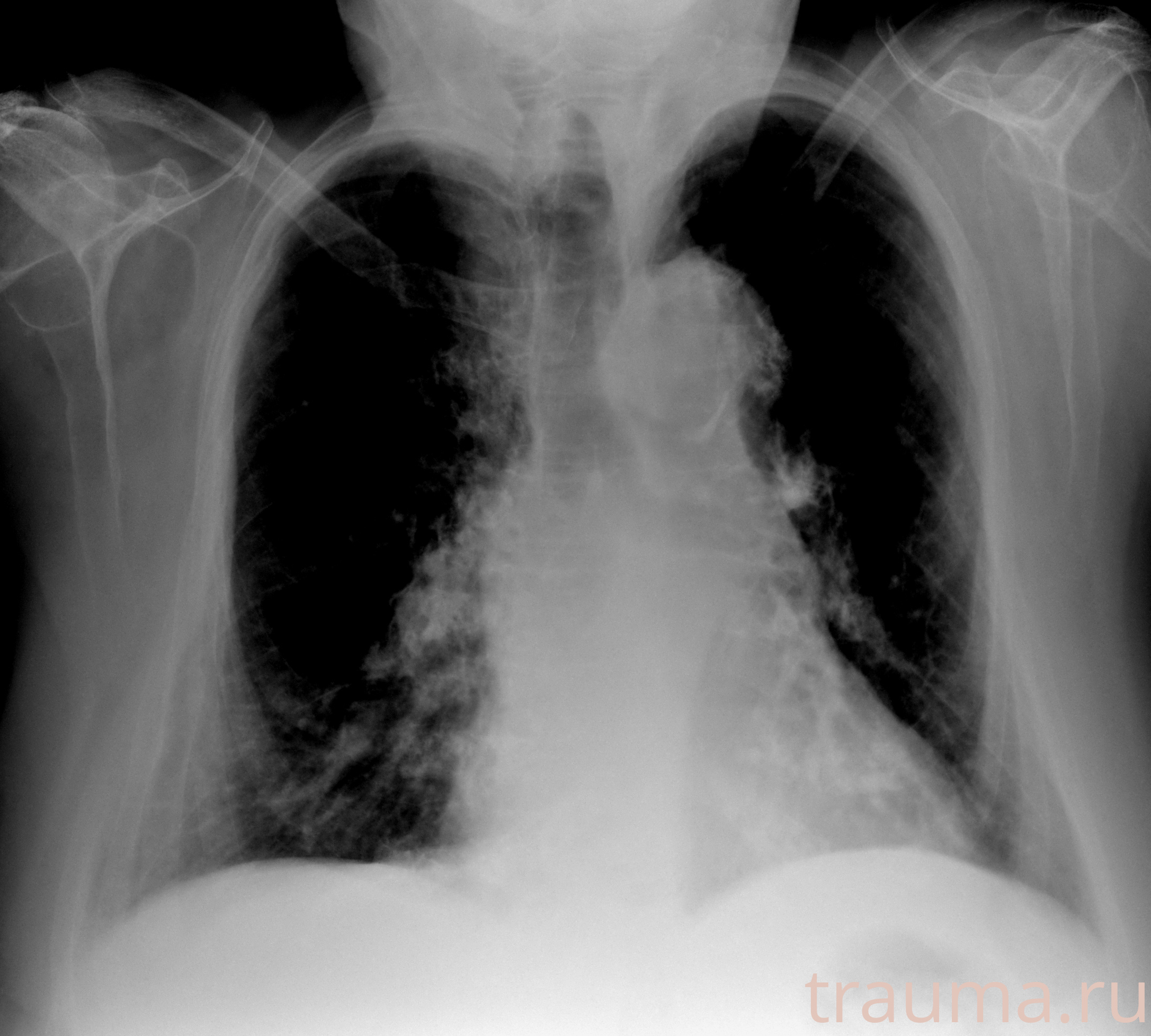 Рентген на дому: по вашему адресу приезжает врач-рентгенолог, травматолог-ортопед с мобильным рентгеновским аппаратом, проводит диагностику травмы или заболевания, делает необходимые рентгенограммы, дает рекомендации по дальнейшему лечению. Получить качественные снимки в домашних условиях возможно благодаря уникальной методике, разработанной МосРентген Центром для института  Склифосовского