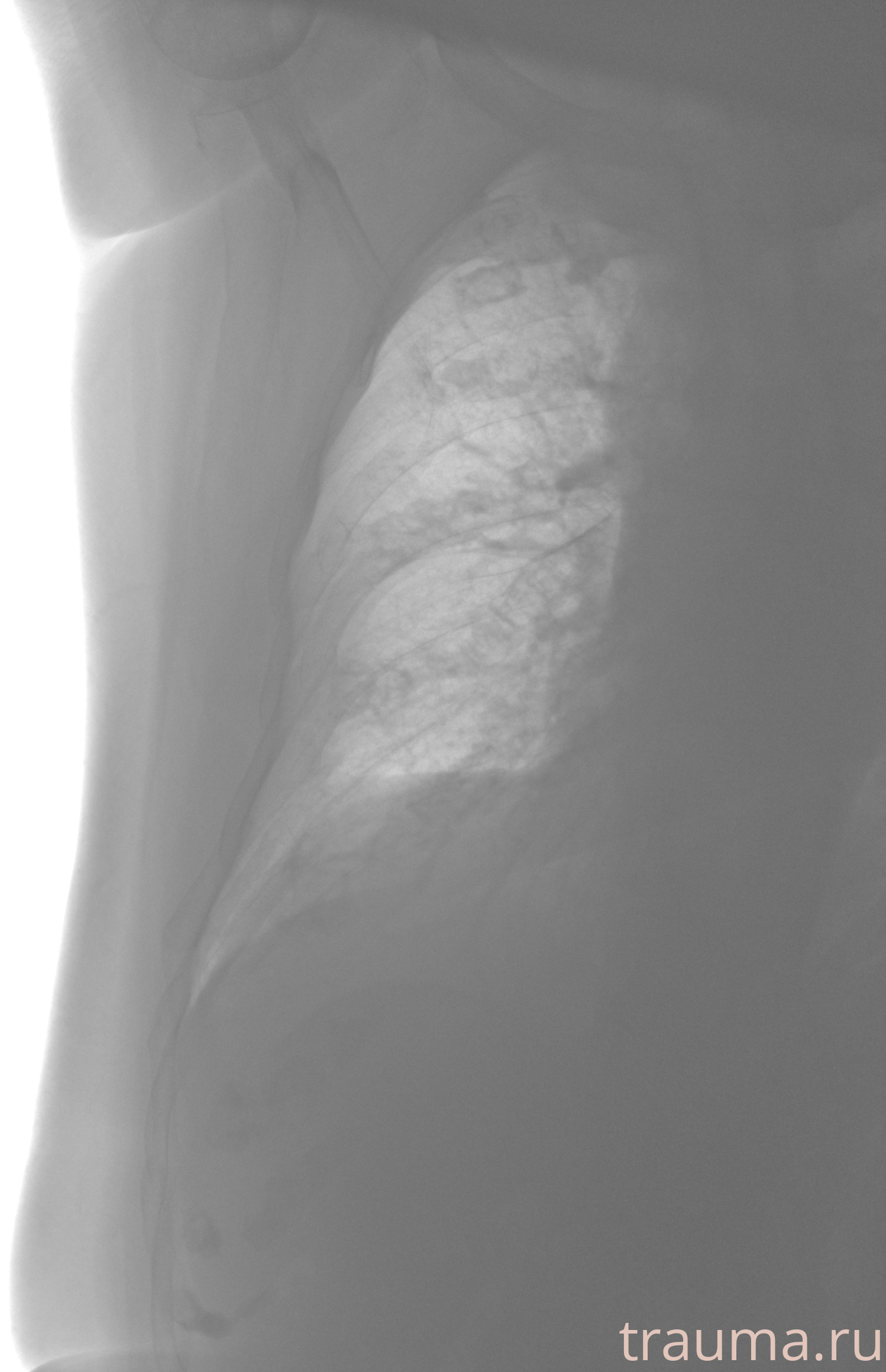 Рентген на дому: по вашему адресу приезжает врач-рентгенолог, травматолог-ортопед с мобильным рентгеновским аппаратом, проводит диагностику травмы или заболевания, делает необходимые рентгенограммы, дает рекомендации по дальнейшему лечению. Получить качественные снимки в домашних условиях возможно благодаря уникальной методике, разработанной МосРентген Центром для института  Склифосовского