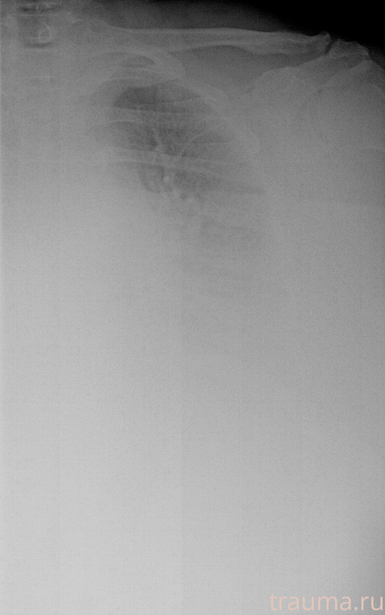 Рентген на дому: по вашему адресу приезжает врач-рентгенолог, травматолог-ортопед с мобильным рентгеновским аппаратом, проводит диагностику травмы или заболевания, делает необходимые рентгенограммы, дает рекомендации по дальнейшему лечению. Получить качественные снимки в домашних условиях возможно благодаря уникальной методике, разработанной МосРентген Центром для института  Склифосовского