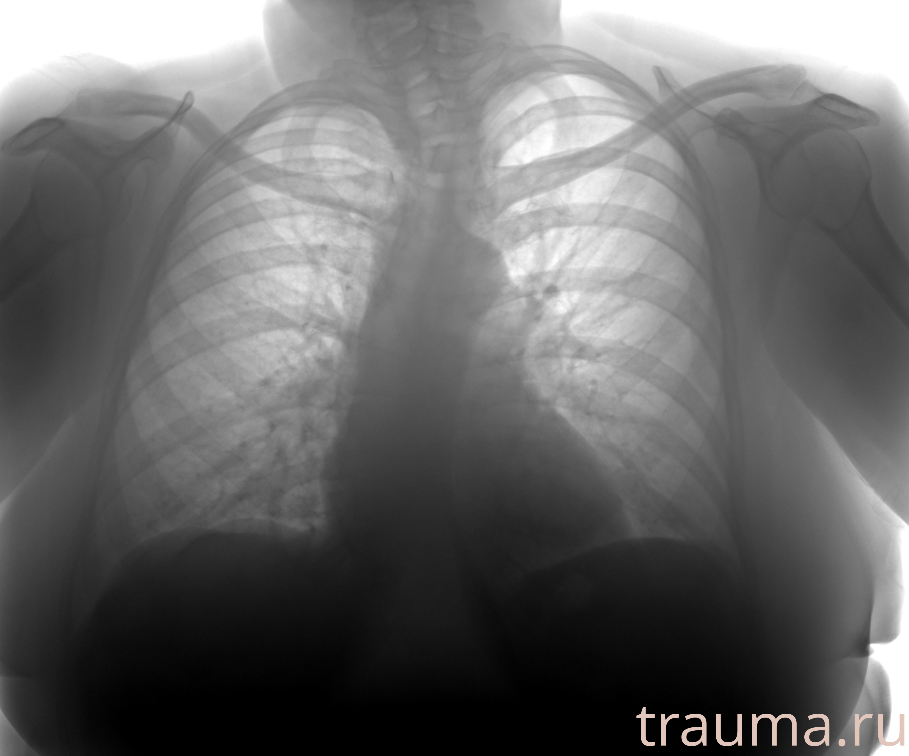 Рентген на дому: по вашему адресу приезжает врач-рентгенолог, травматолог-ортопед с мобильным рентгеновским аппаратом, проводит диагностику травмы или заболевания, делает необходимые рентгенограммы, дает рекомендации по дальнейшему лечению. Получить качественные снимки в домашних условиях возможно благодаря уникальной методике, разработанной МосРентген Центром для института  Склифосовского