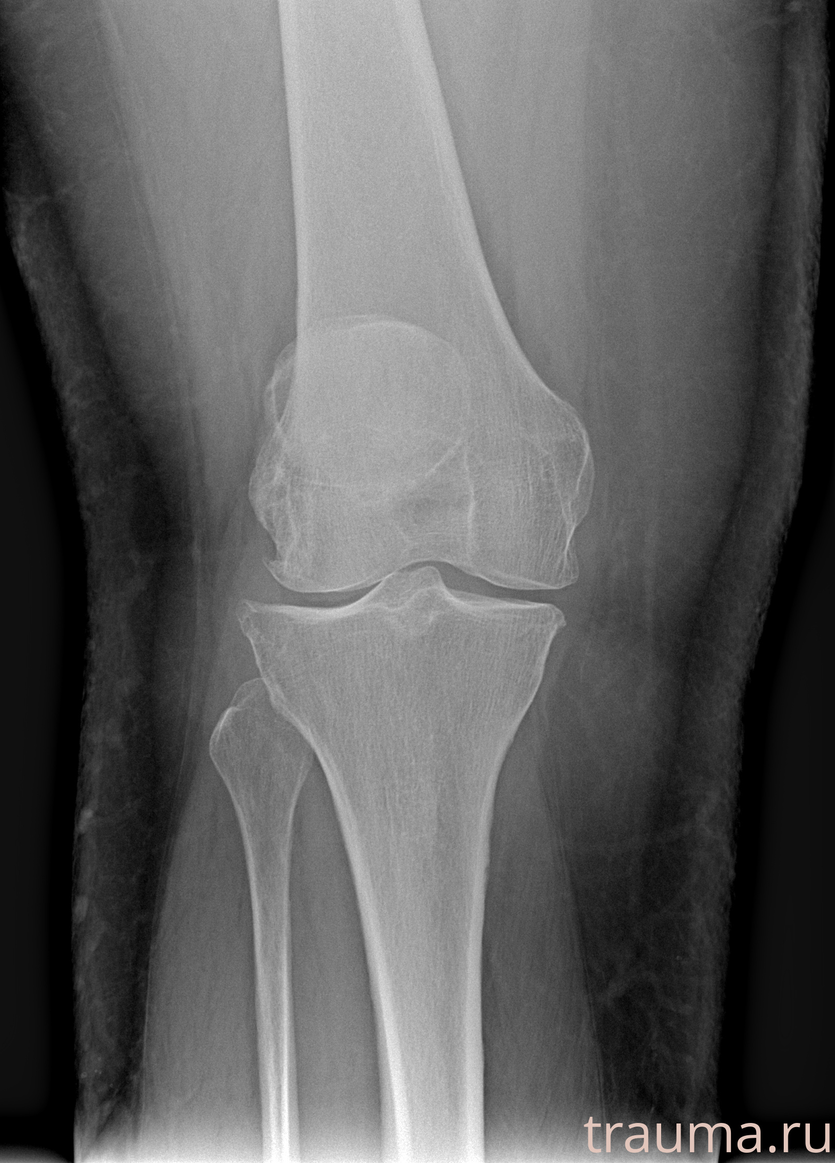 Рентген на дому: по вашему адресу приезжает врач-рентгенолог, травматолог-ортопед с мобильным рентгеновским аппаратом, проводит диагностику травмы или заболевания, делает необходимые рентгенограммы, дает рекомендации по дальнейшему лечению. Получить качественные снимки в домашних условиях возможно благодаря уникальной методике, разработанной МосРентген Центром для института  Склифосовского