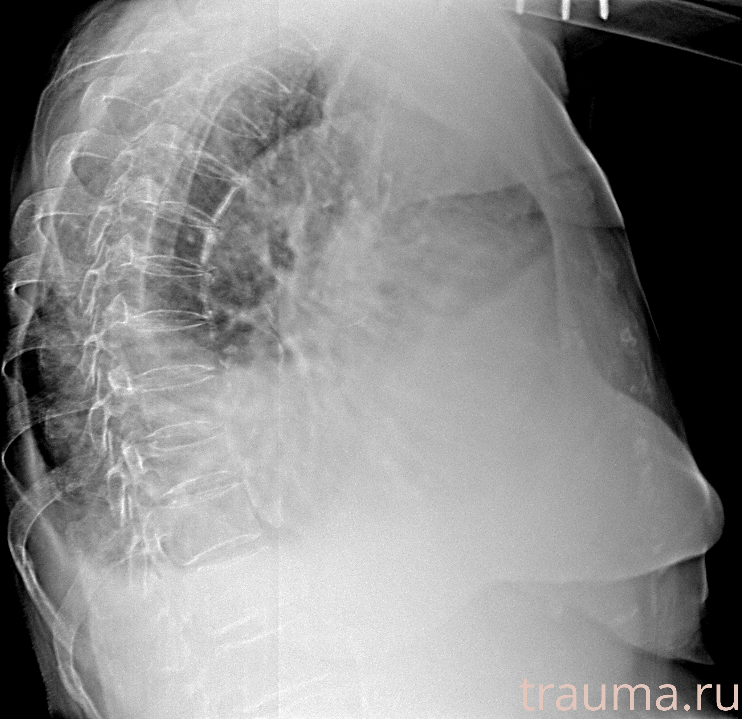 Рентген на дому: по вашему адресу приезжает врач-рентгенолог, травматолог-ортопед с мобильным рентгеновским аппаратом, проводит диагностику травмы или заболевания, делает необходимые рентгенограммы, дает рекомендации по дальнейшему лечению. Получить качественные снимки в домашних условиях возможно благодаря уникальной методике, разработанной МосРентген Центром для института  Склифосовского