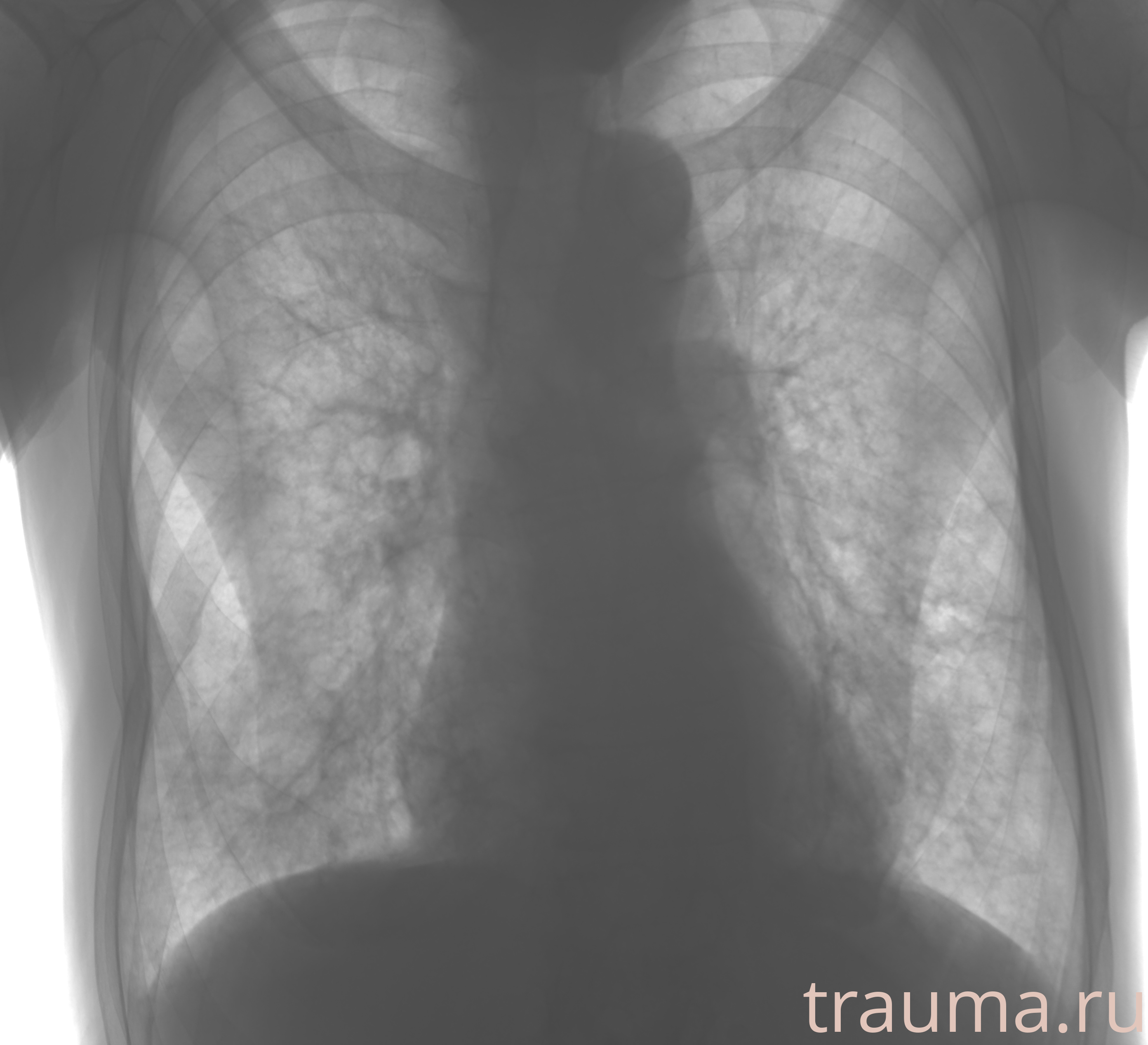 Рентген на дому: по вашему адресу приезжает врач-рентгенолог, травматолог-ортопед с мобильным рентгеновским аппаратом, проводит диагностику травмы или заболевания, делает необходимые рентгенограммы, дает рекомендации по дальнейшему лечению. Получить качественные снимки в домашних условиях возможно благодаря уникальной методике, разработанной МосРентген Центром для института  Склифосовского