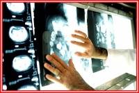 Обзор списка приема пациентов веб-PACS в программе для цифровой рентгенографии Image Suite версии 4.0