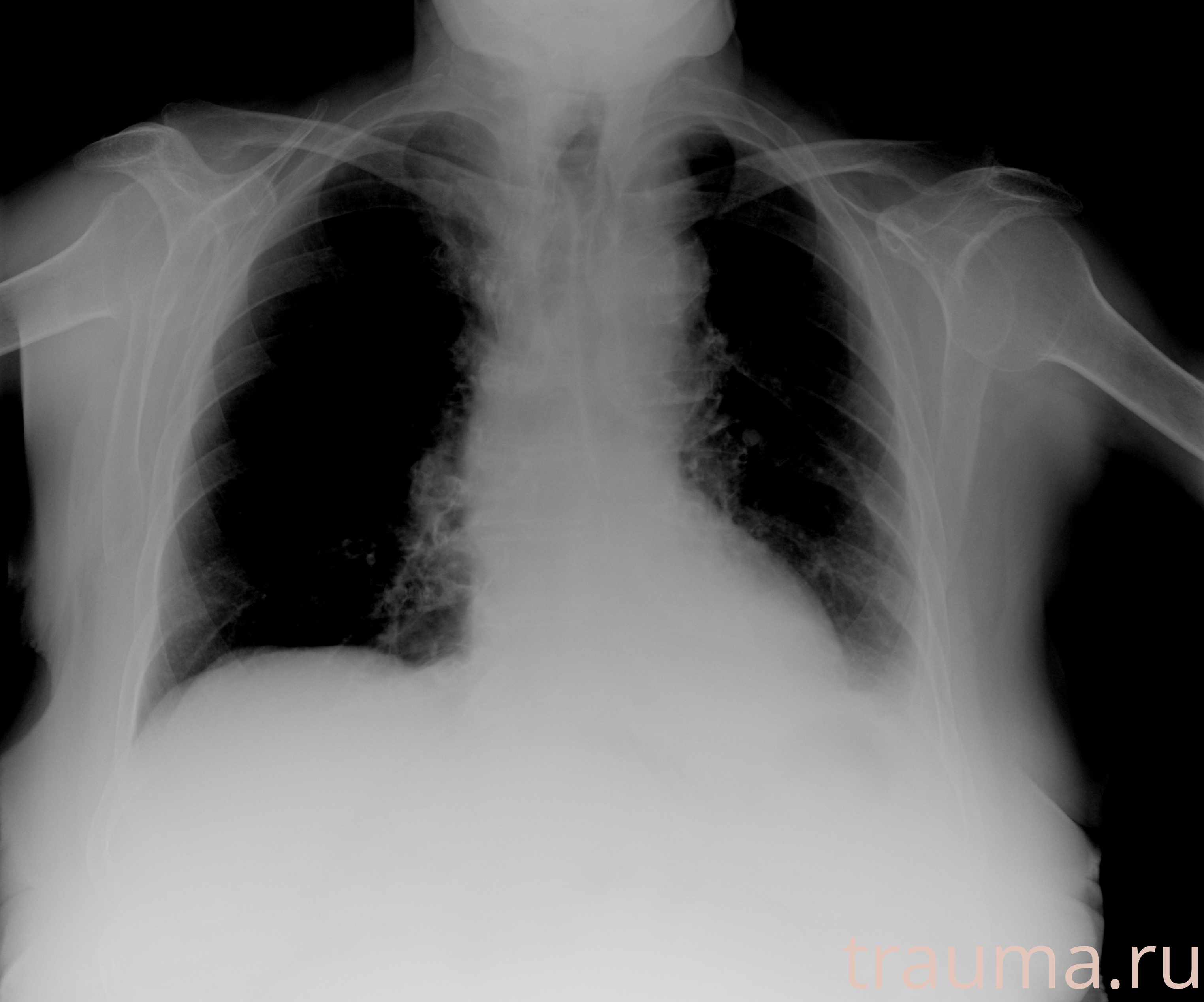 Рентген на дому: по вашему адресу приезжает врач-рентгенолог, травматолог-ортопед с мобильным рентгеновским аппаратом, проводит диагностику травмы или заболевания, делает необходимые рентгенограммы, дает рекомендации по дальнейшему лечению. Получить качественные снимки в домашних условиях возможно благодаря уникальной методике, разработанной МосРентген Центром для института  Склифосовского