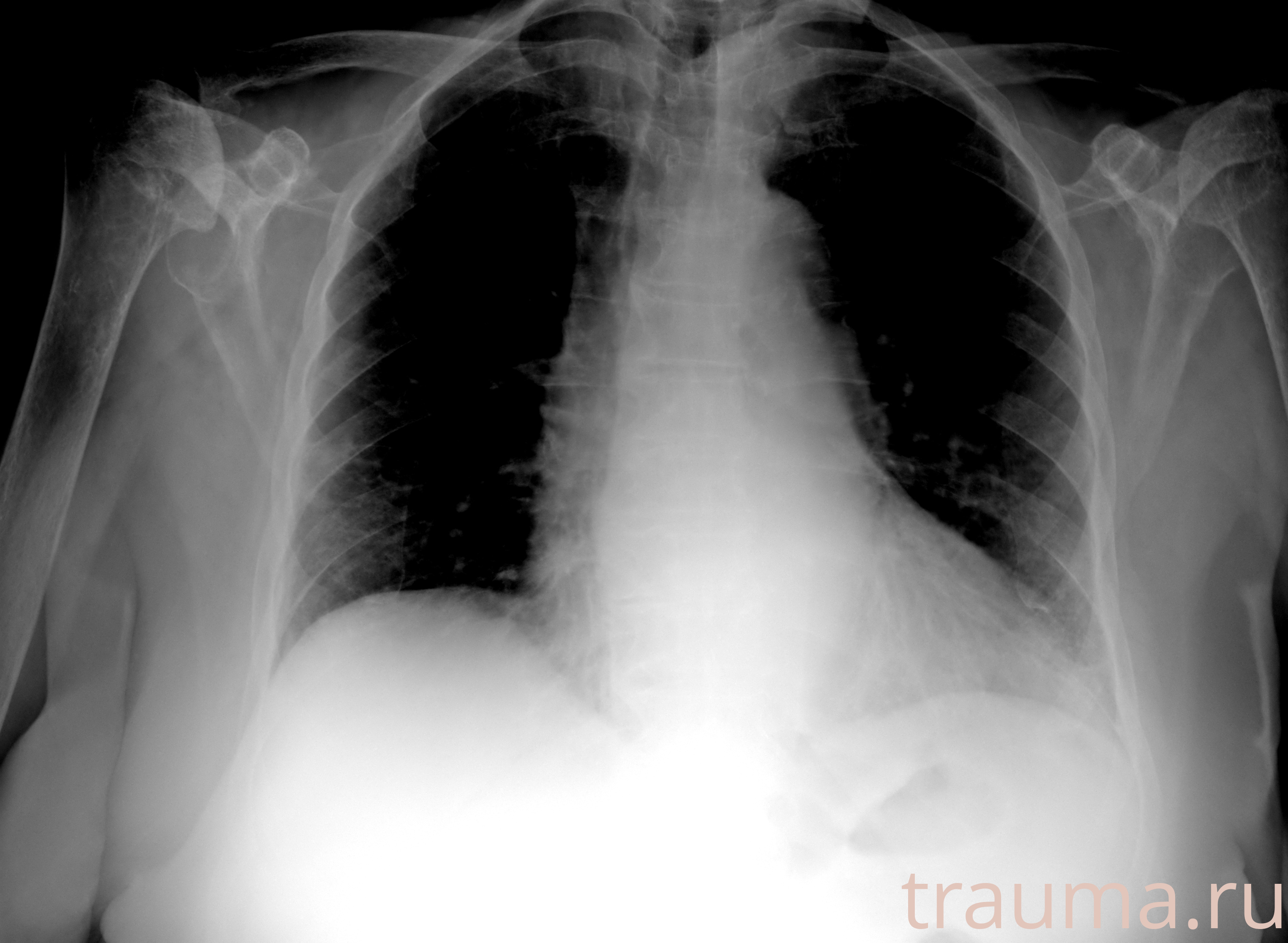 Рентген на дому: по вашему адресу приезжает врач-рентгенолог, травматолог-ортопед с мобильным рентгеновским аппаратом, проводит диагностику травмы или заболевания, делает необходимые рентгенограммы, дает рекомендации по дальнейшему лечению. Получить качественные снимки в домашних условиях возможно благодаря уникальной методике, разработанной МосРентген Центром для института  Склифосовского