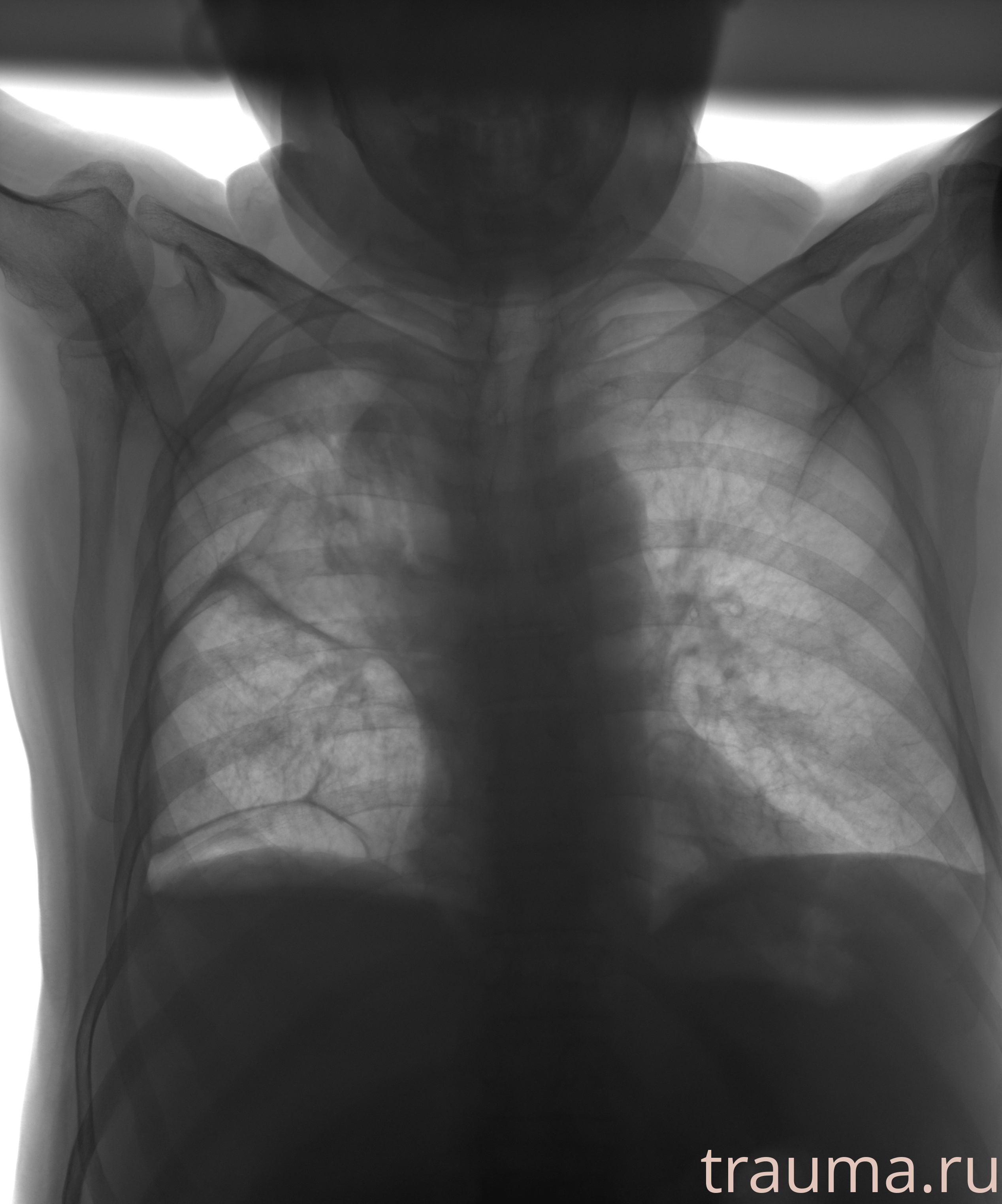 Рентген на дому: по вашему адресу приезжает врач-рентгенолог, травматолог-ортопед с мобильным рентгеновским аппаратом, проводит диагностику травмы или заболевания, делает необходимые рентгенограммы, дает рекомендации по дальнейшему лечению. Получить качественные снимки в домашних условиях возможно благодаря уникальной методике, разработанной МосРентген Центром для института  Склифосовского