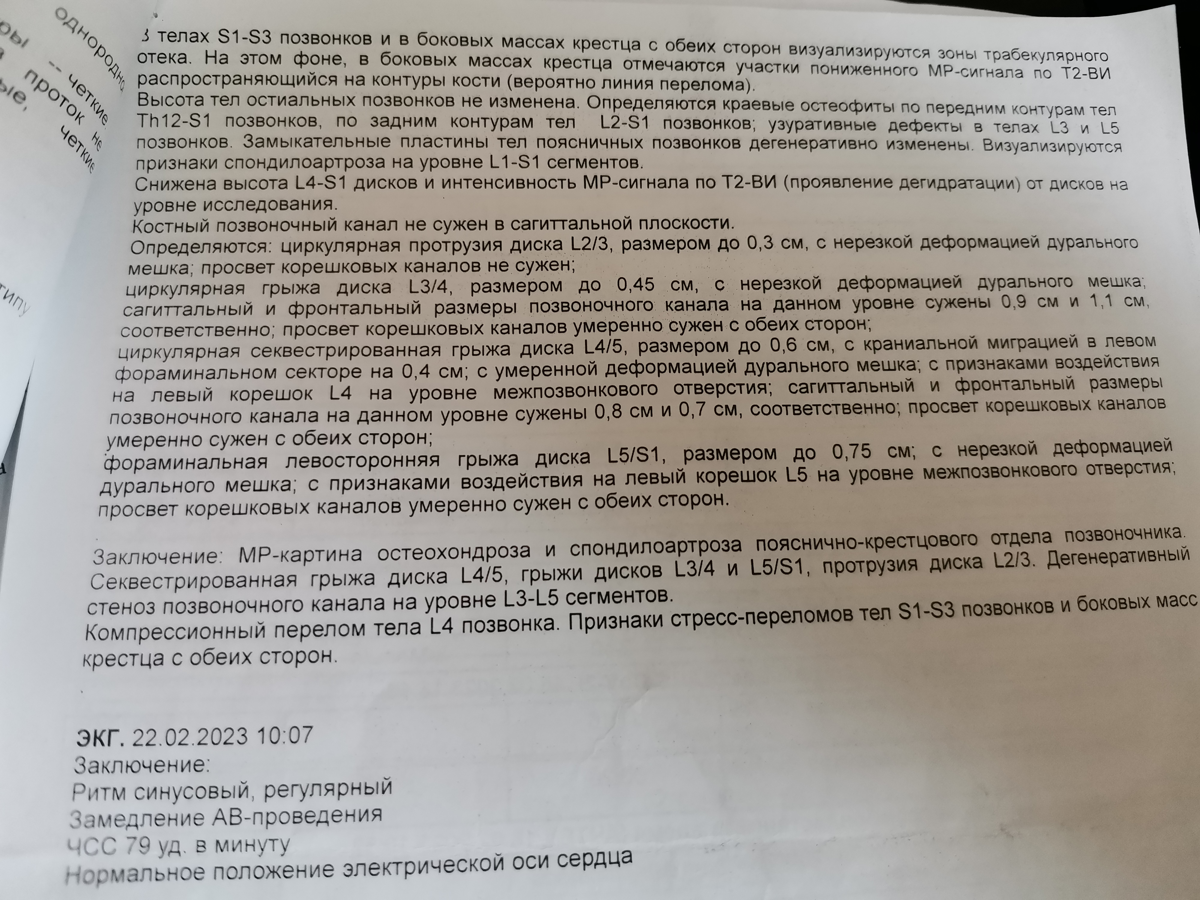 Рентген на дому: по вашему адресу приезжает врач-рентгенолог, травматолог-ортопед с мобильным рентгеновским аппаратом, проводит диагностику травмы или заболевания, делает необходимые рентгенограммы, дает рекомендации по дальнейшему лечению. Получить качественные снимки в домашних условиях возможно благодаря уникальной методике, разработанной МосРентген Центром для института  Склифосовского