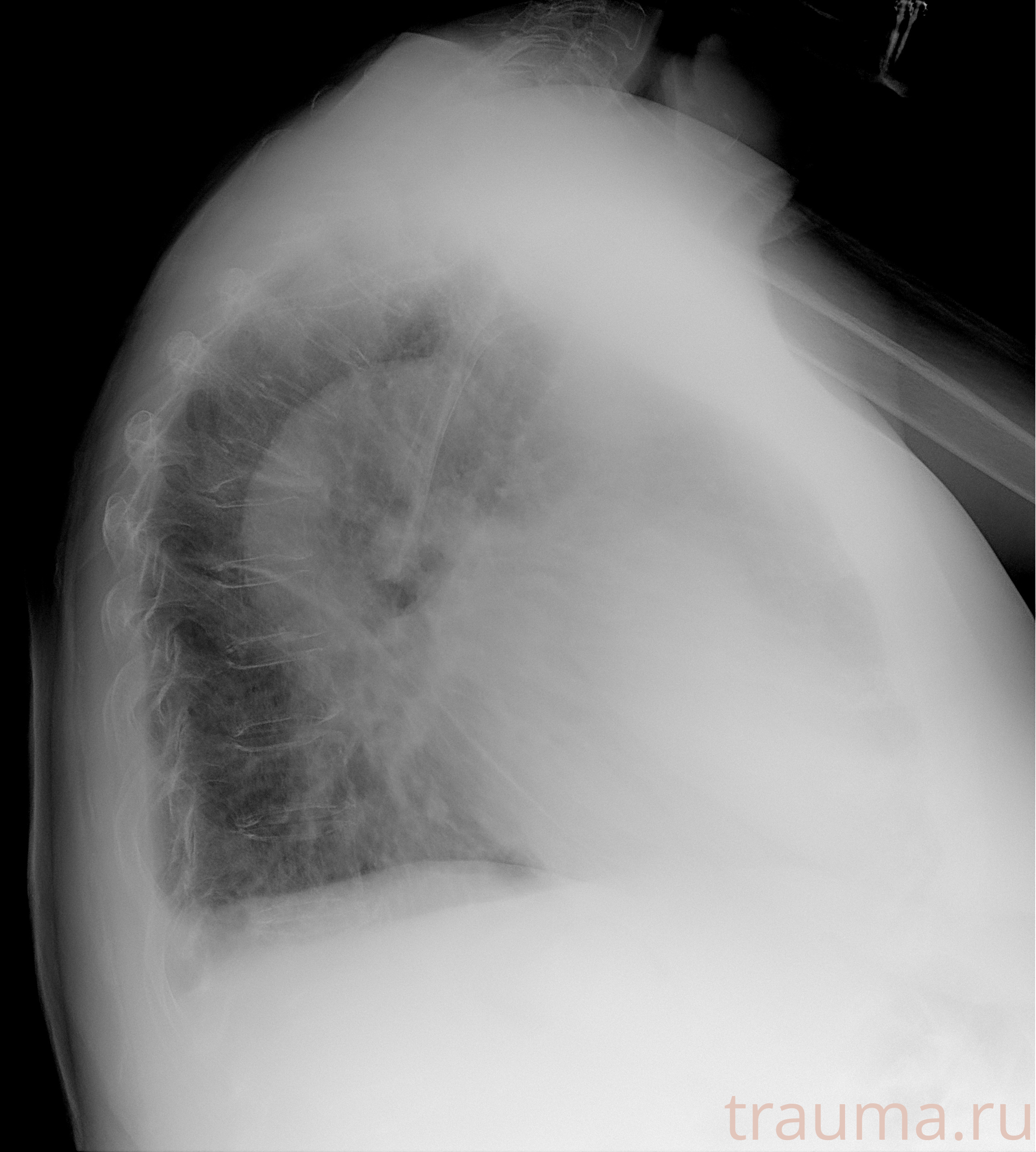 Рентген на дому: по вашему адресу приезжает врач-рентгенолог, травматолог-ортопед с мобильным рентгеновским аппаратом, проводит диагностику травмы или заболевания, делает необходимые рентгенограммы, дает рекомендации по дальнейшему лечению. Получить качественные снимки в домашних условиях возможно благодаря уникальной методике, разработанной МосРентген Центром для института  Склифосовского