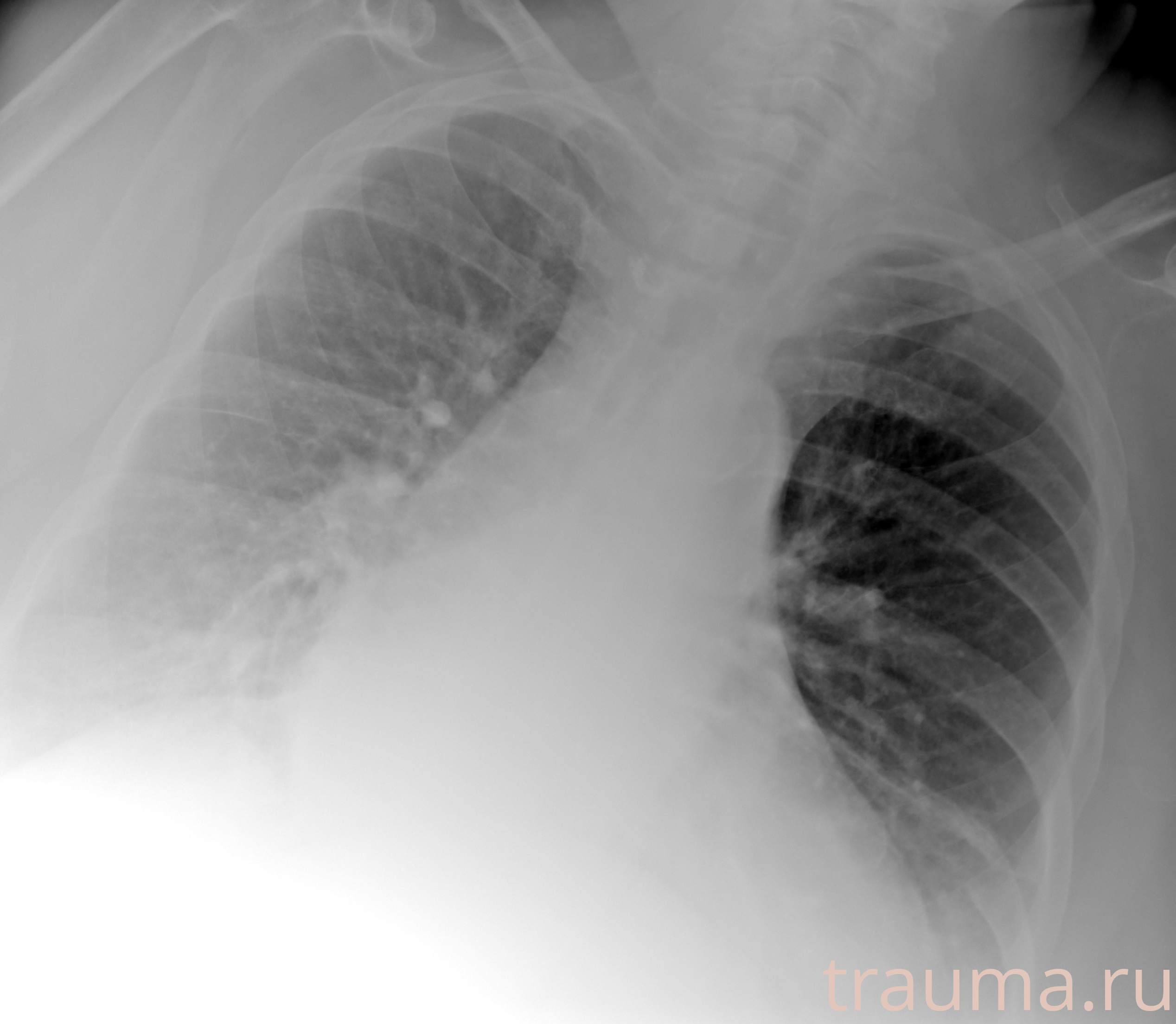 Рентген на дому: по вашему адресу приезжает врач-рентгенолог, травматолог-ортопед с мобильным рентгеновским аппаратом, проводит диагностику травмы или заболевания, делает необходимые рентгенограммы, дает рекомендации по дальнейшему лечению. Получить качественные снимки в домашних условиях возможно благодаря уникальной методике, разработанной МосРентген Центром для института  Склифосовского