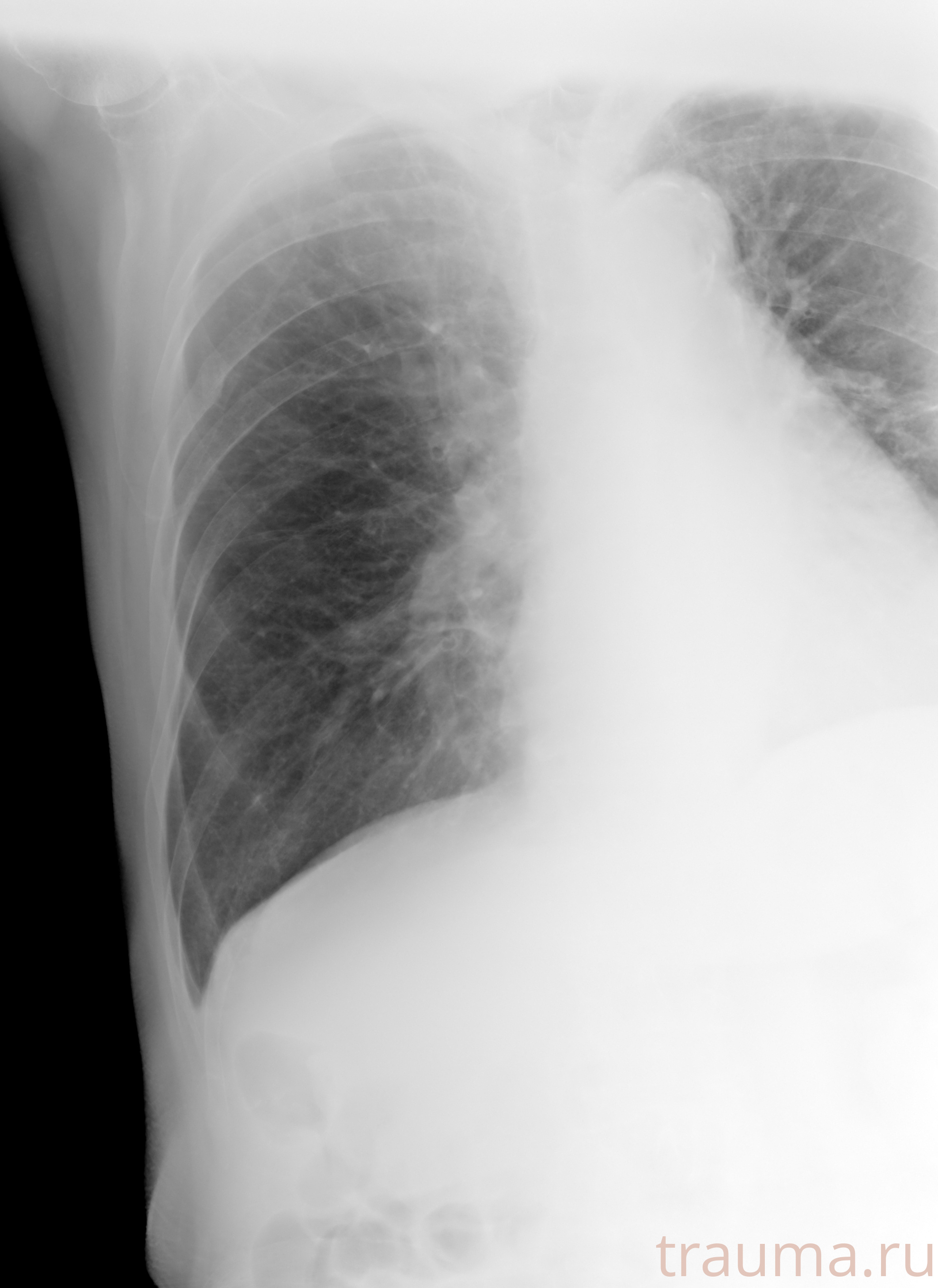 Рентген на дому: по вашему адресу приезжает врач-рентгенолог, травматолог-ортопед с мобильным рентгеновским аппаратом, проводит диагностику травмы или заболевания, делает необходимые рентгенограммы, дает рекомендации по дальнейшему лечению. Получить качественные снимки в домашних условиях возможно благодаря уникальной методике, разработанной МосРентген Центром для института  Склифосовского