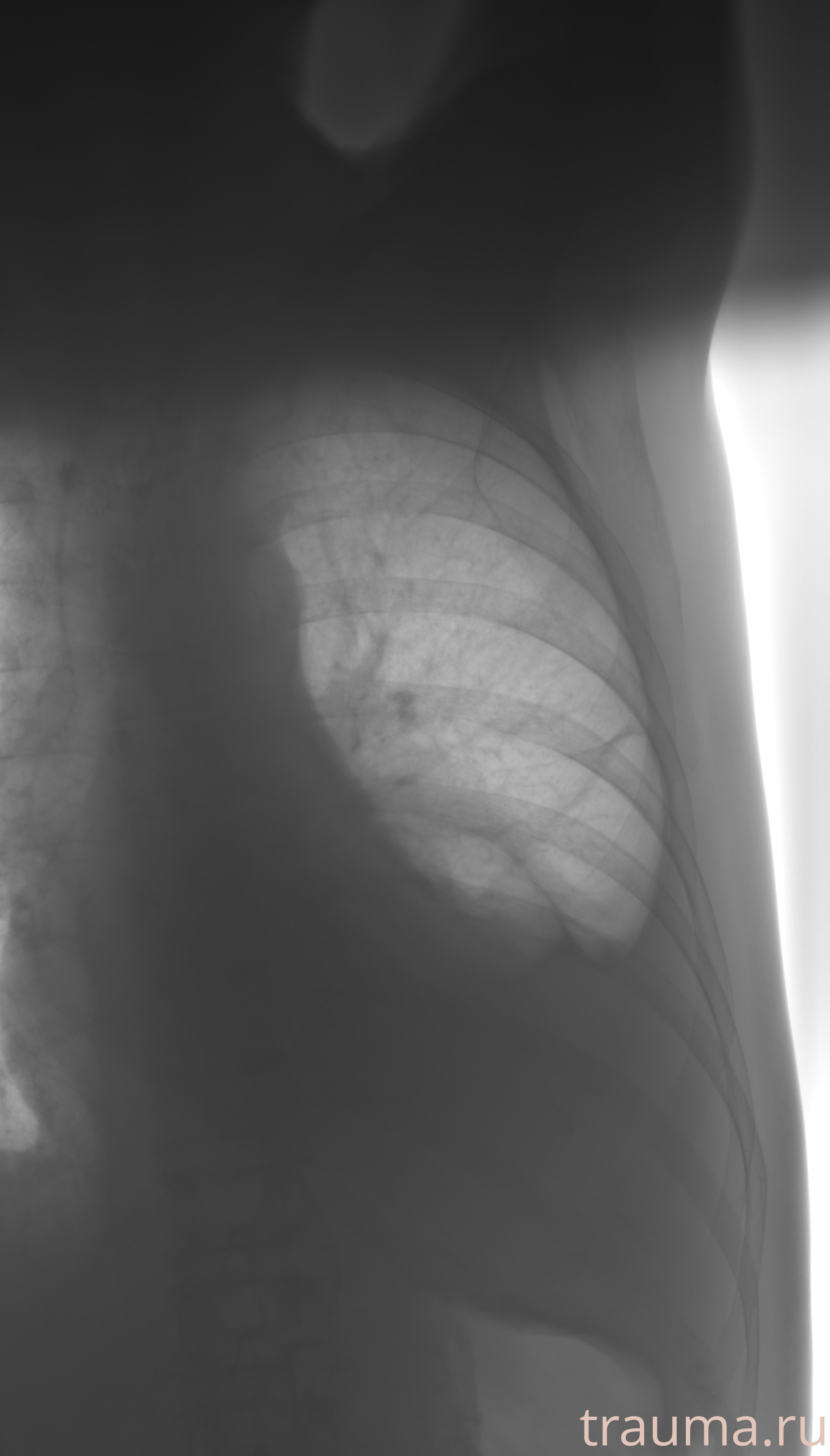 Рентген на дому: по вашему адресу приезжает врач-рентгенолог, травматолог-ортопед с мобильным рентгеновским аппаратом, проводит диагностику травмы или заболевания, делает необходимые рентгенограммы, дает рекомендации по дальнейшему лечению. Получить качественные снимки в домашних условиях возможно благодаря уникальной методике, разработанной МосРентген Центром для института  Склифосовского