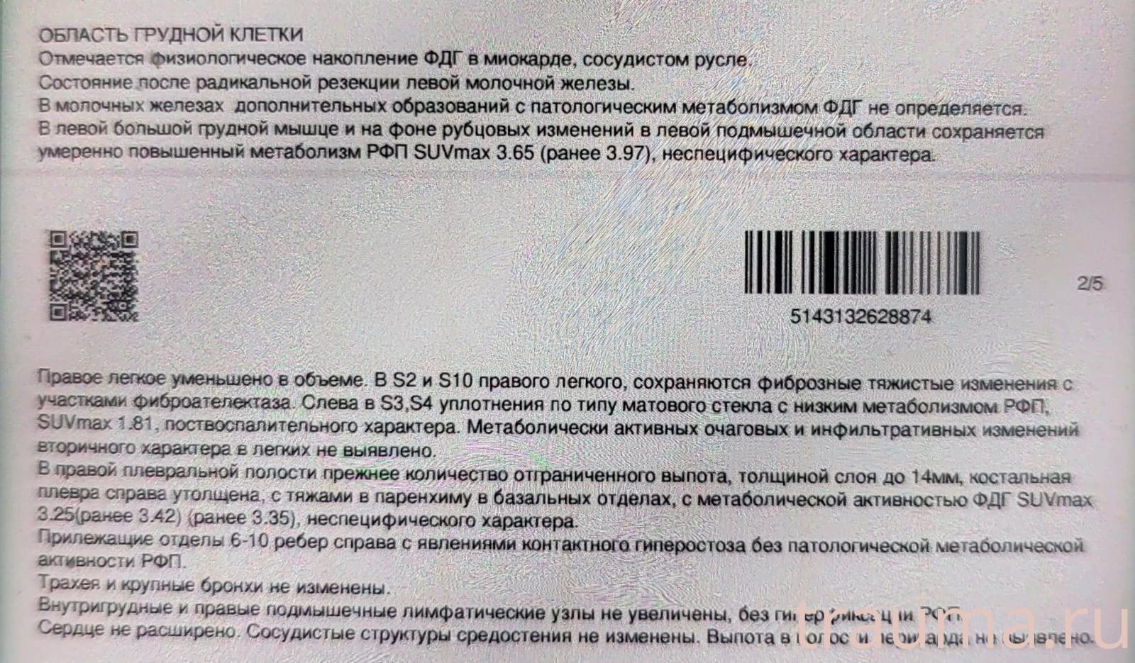 Рентген на дому: по вашему адресу приезжает врач-рентгенолог, травматолог-ортопед с мобильным рентгеновским аппаратом, проводит диагностику травмы или заболевания, делает необходимые рентгенограммы, дает рекомендации по дальнейшему лечению. Получить качественные снимки в домашних условиях возможно благодаря уникальной методике, разработанной МосРентген Центром для института  Склифосовского