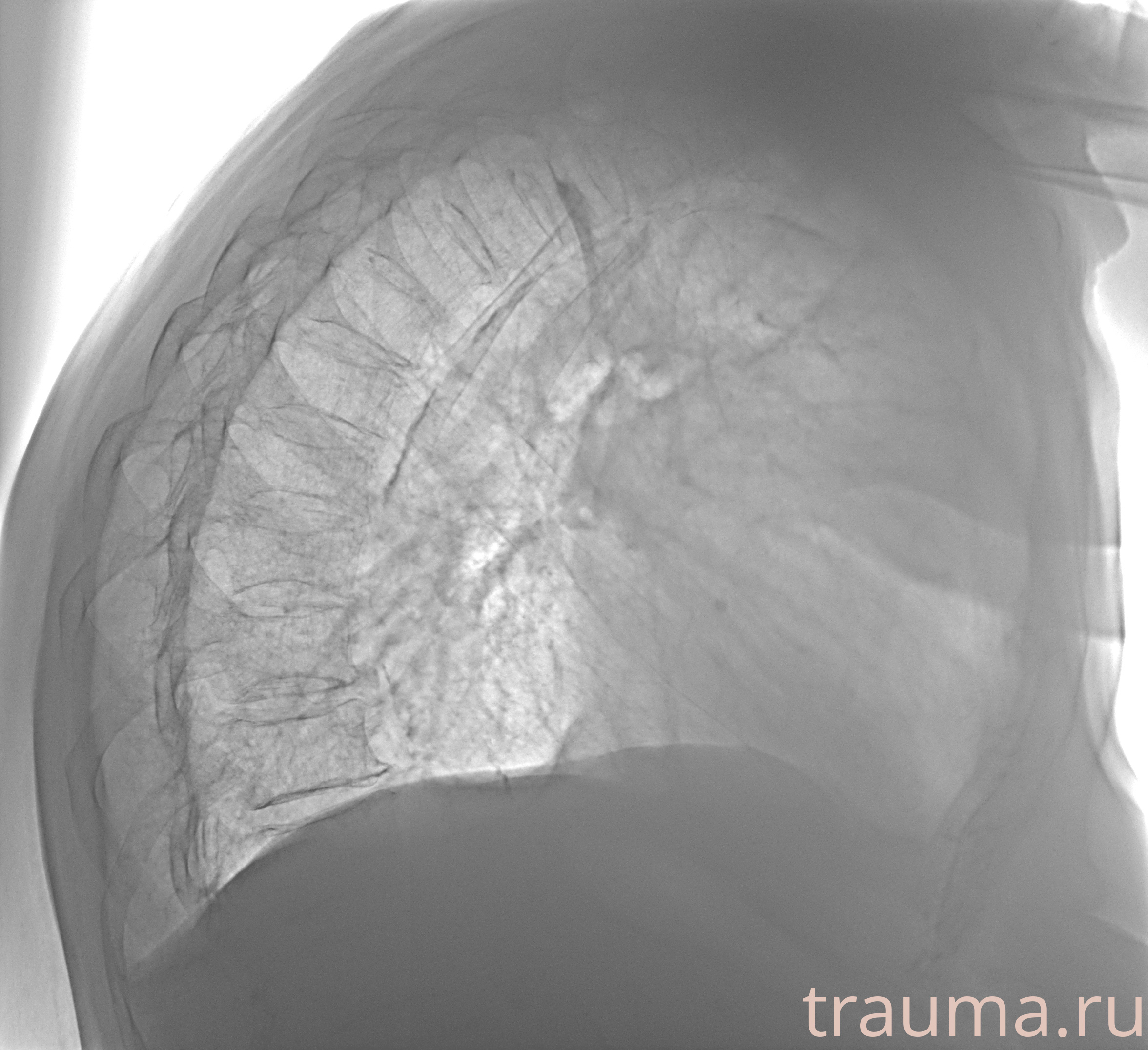 Рентген на дому: по вашему адресу приезжает врач-рентгенолог, травматолог-ортопед с мобильным рентгеновским аппаратом, проводит диагностику травмы или заболевания, делает необходимые рентгенограммы, дает рекомендации по дальнейшему лечению. Получить качественные снимки в домашних условиях возможно благодаря уникальной методике, разработанной МосРентген Центром для института  Склифосовского