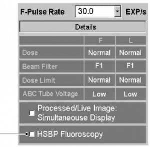 Высокоскоростная двухпроекционная рентгеноскопия 
(HSBP рентгеноскопия)