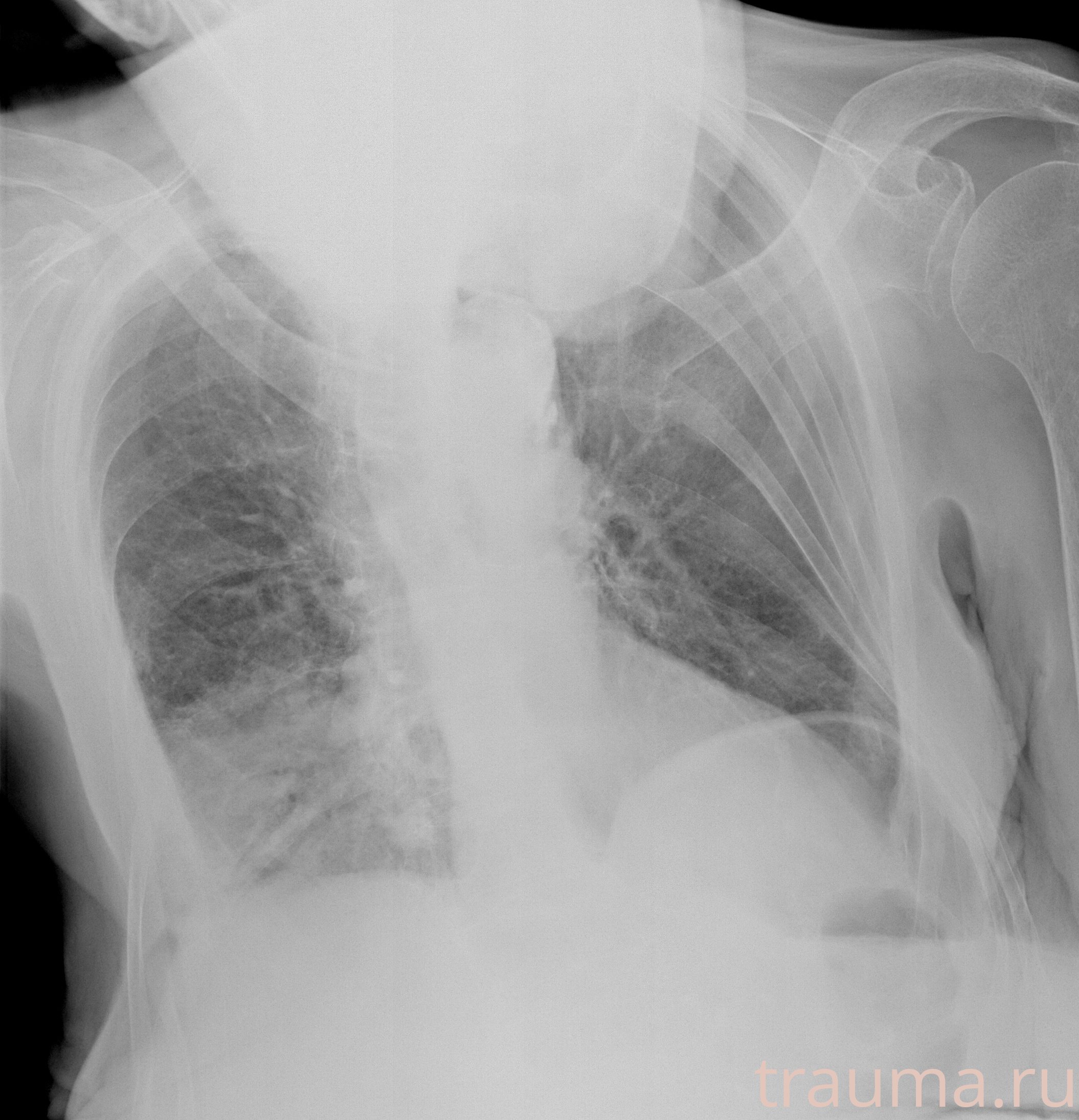 Рентген на дому: по вашему адресу приезжает врач-рентгенолог, травматолог-ортопед с мобильным рентгеновским аппаратом, проводит диагностику травмы или заболевания, делает необходимые рентгенограммы, дает рекомендации по дальнейшему лечению. Получить качественные снимки в домашних условиях возможно благодаря уникальной методике, разработанной МосРентген Центром для института  Склифосовского