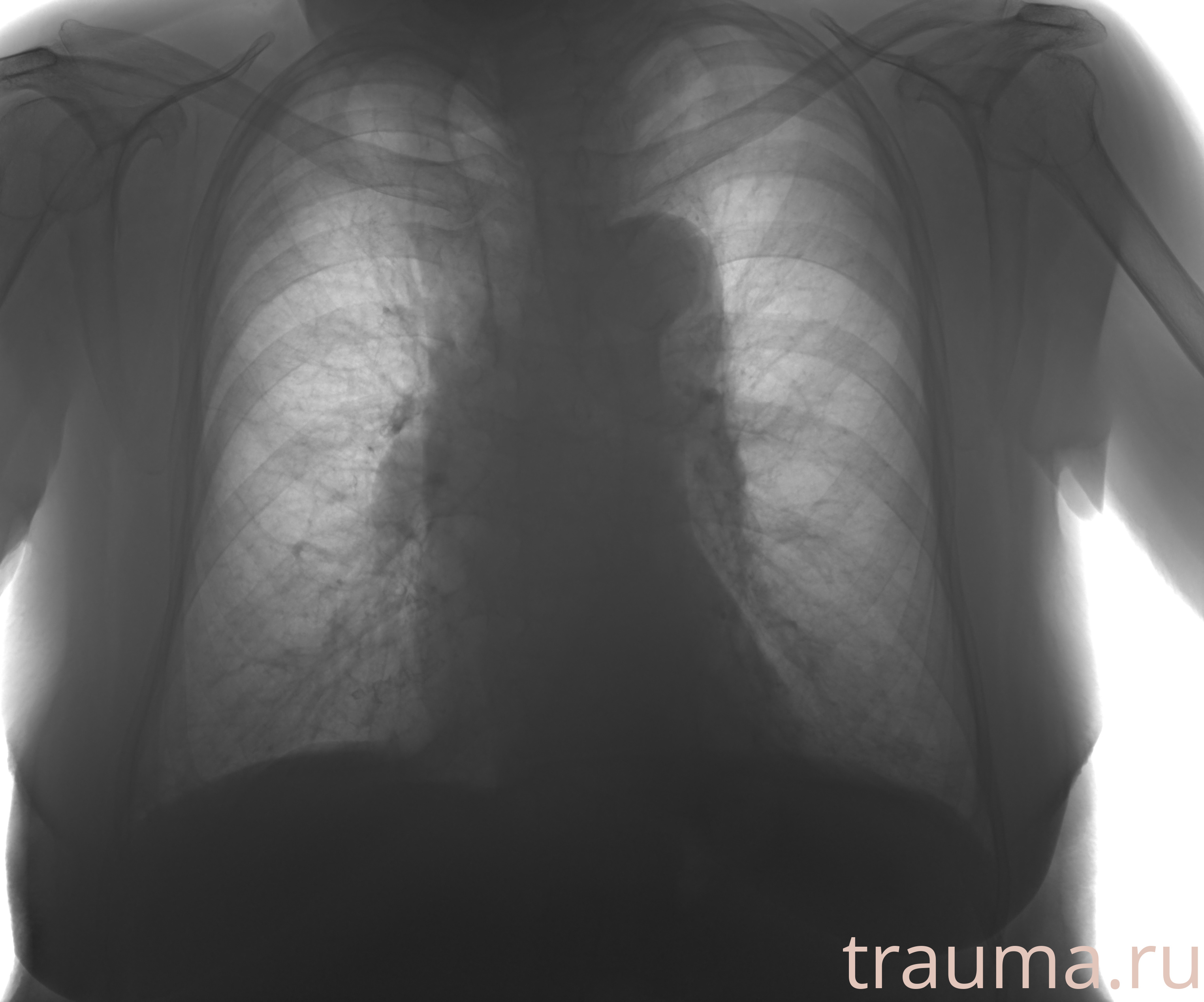 Рентген на дому: по вашему адресу приезжает врач-рентгенолог, травматолог-ортопед с мобильным рентгеновским аппаратом, проводит диагностику травмы или заболевания, делает необходимые рентгенограммы, дает рекомендации по дальнейшему лечению. Получить качественные снимки в домашних условиях возможно благодаря уникальной методике, разработанной МосРентген Центром для института  Склифосовского