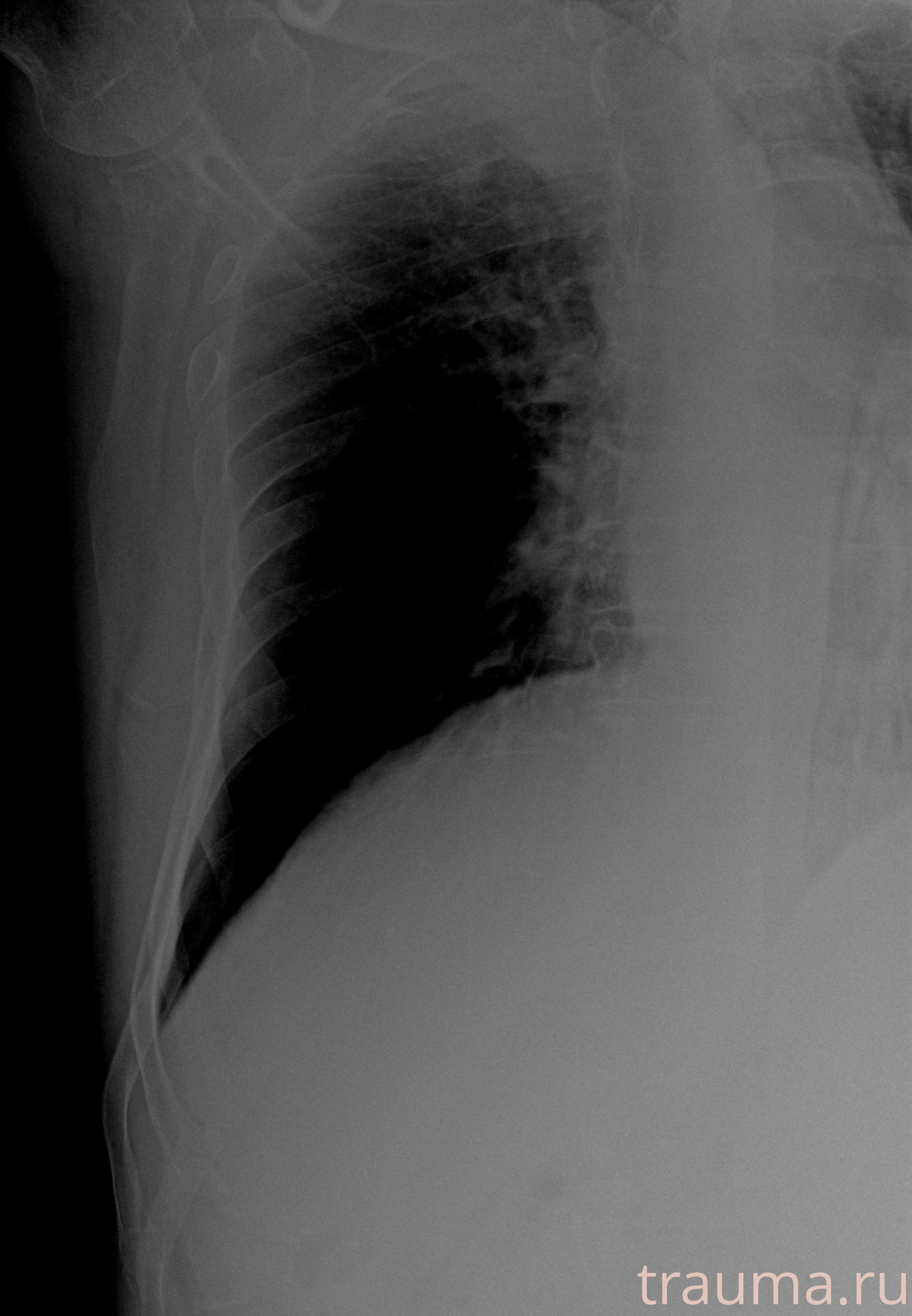 Рентген на дому: по вашему адресу приезжает врач-рентгенолог, травматолог-ортопед с мобильным рентгеновским аппаратом, проводит диагностику травмы или заболевания, делает необходимые рентгенограммы, дает рекомендации по дальнейшему лечению. Получить качественные снимки в домашних условиях возможно благодаря уникальной методике, разработанной МосРентген Центром для института  Склифосовского
