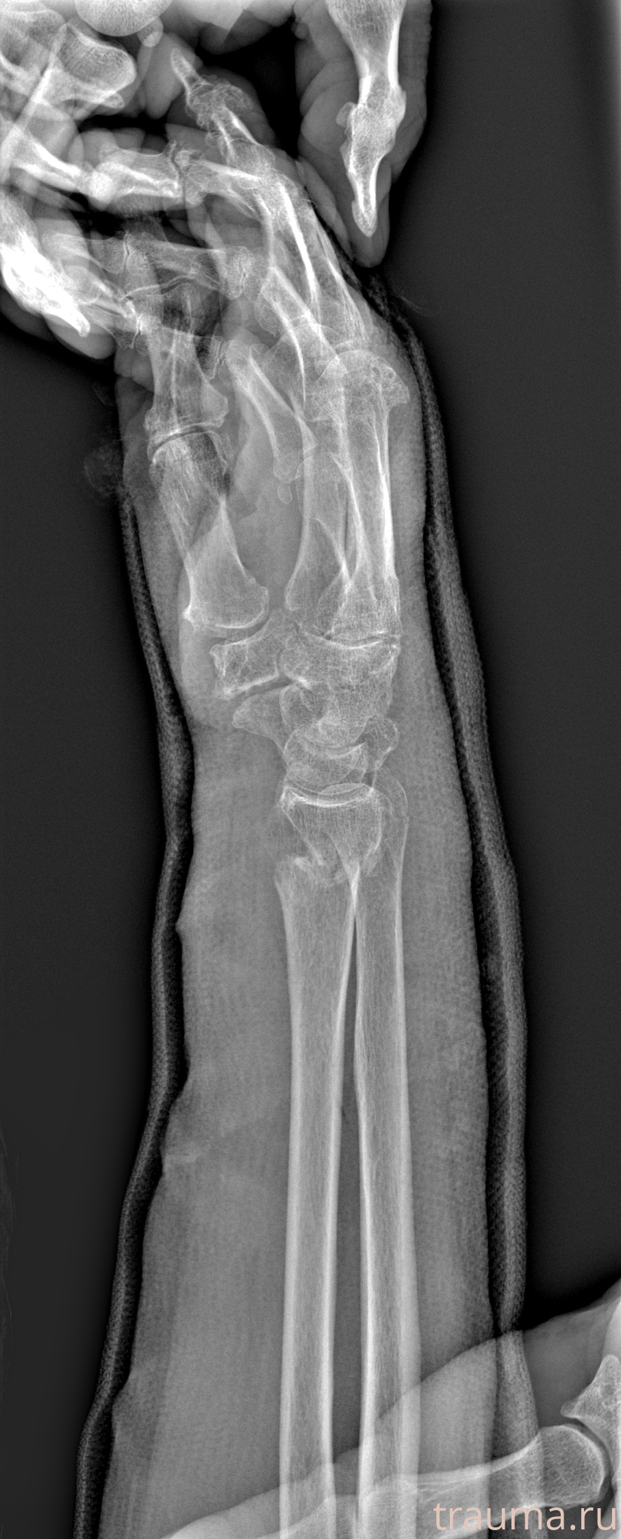 Рентген на дому: по вашему адресу приезжает врач-рентгенолог, травматолог-ортопед с мобильным рентгеновским аппаратом, проводит диагностику травмы или заболевания, делает необходимые рентгенограммы, дает рекомендации по дальнейшему лечению. Получить качественные снимки в домашних условиях возможно благодаря уникальной методике, разработанной МосРентген Центром для института  Склифосовского