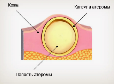 Десяток шишек на голове…