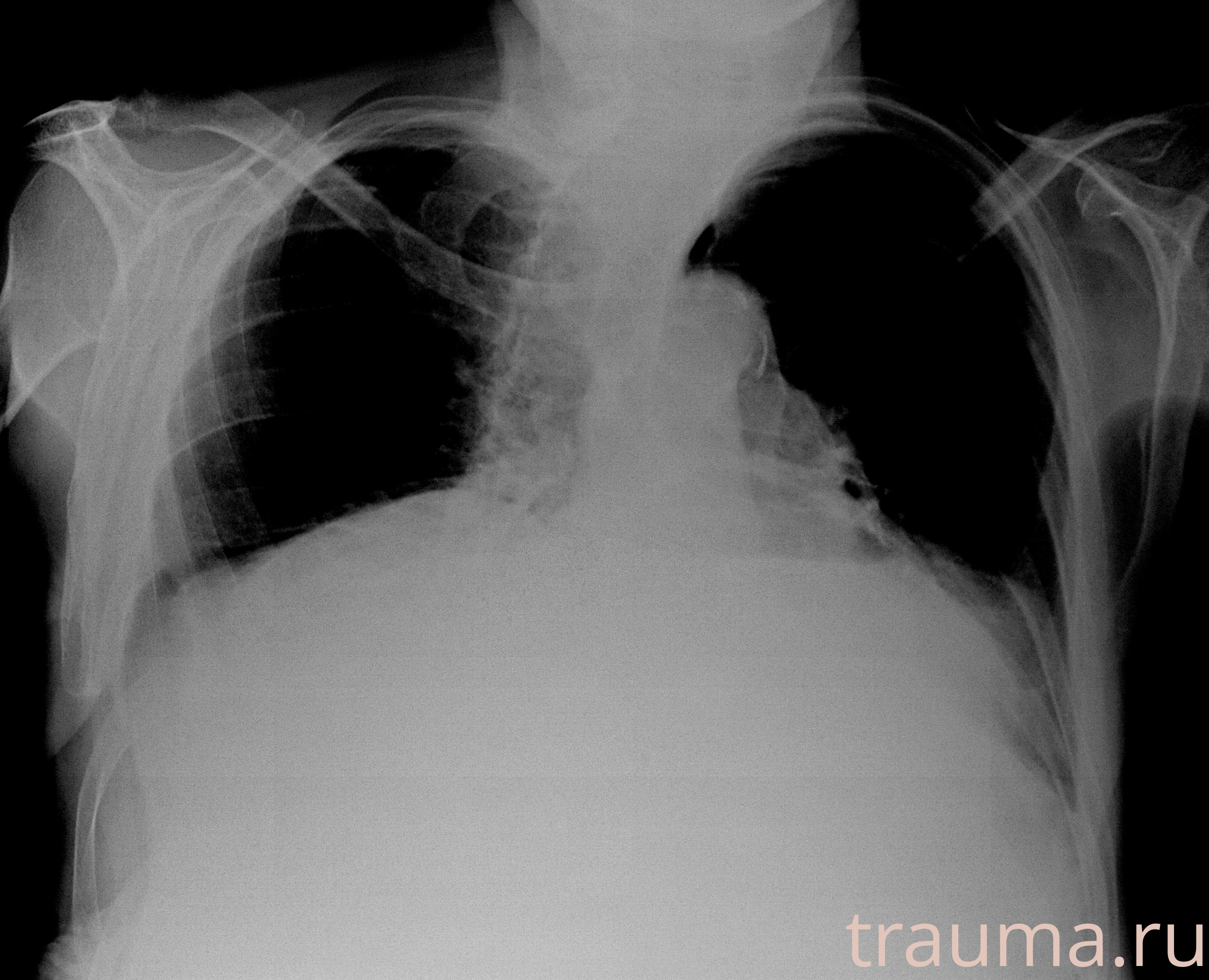 Рентген на дому: по вашему адресу приезжает врач-рентгенолог, травматолог-ортопед с мобильным рентгеновским аппаратом, проводит диагностику травмы или заболевания, делает необходимые рентгенограммы, дает рекомендации по дальнейшему лечению. Получить качественные снимки в домашних условиях возможно благодаря уникальной методике, разработанной МосРентген Центром для института  Склифосовского