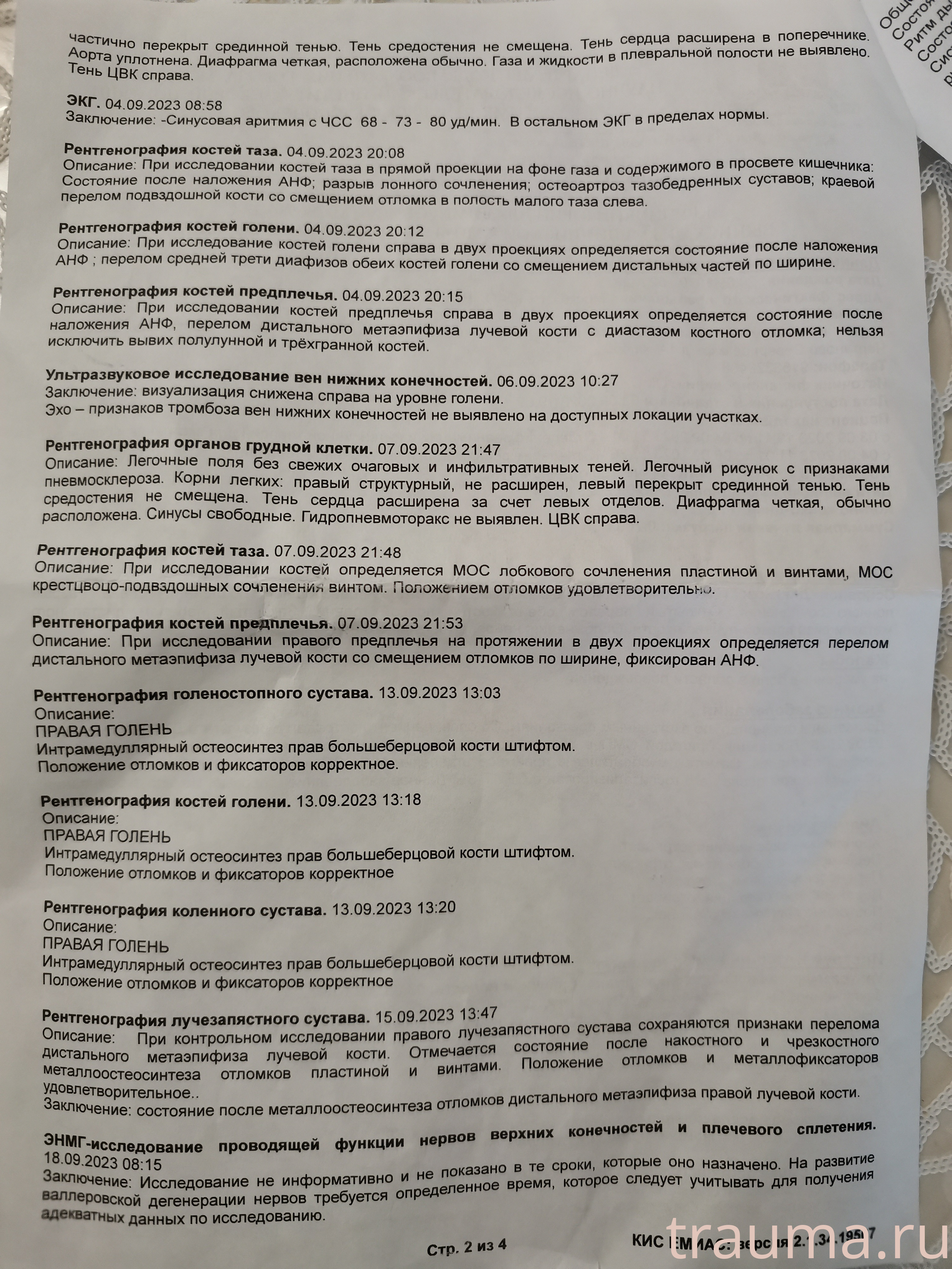 Рентген на дому: по вашему адресу приезжает врач-рентгенолог, травматолог-ортопед с мобильным рентгеновским аппаратом, проводит диагностику травмы или заболевания, делает необходимые рентгенограммы, дает рекомендации по дальнейшему лечению. Получить качественные снимки в домашних условиях возможно благодаря уникальной методике, разработанной МосРентген Центром для института  Склифосовского